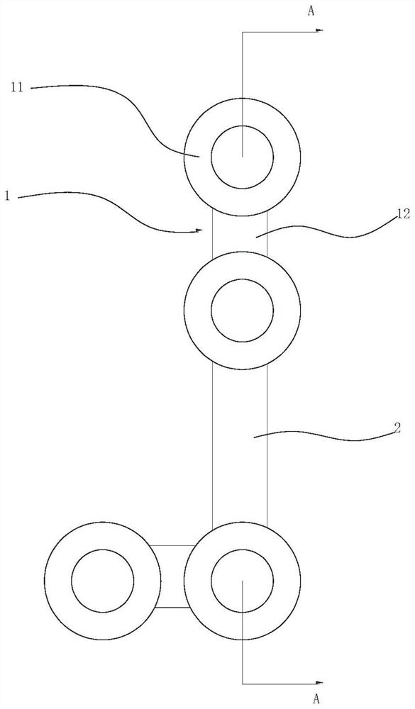 Hand and Foot Surgical Fixation System Based on Magnesium-Based Alloy or Zinc-Based Alloy