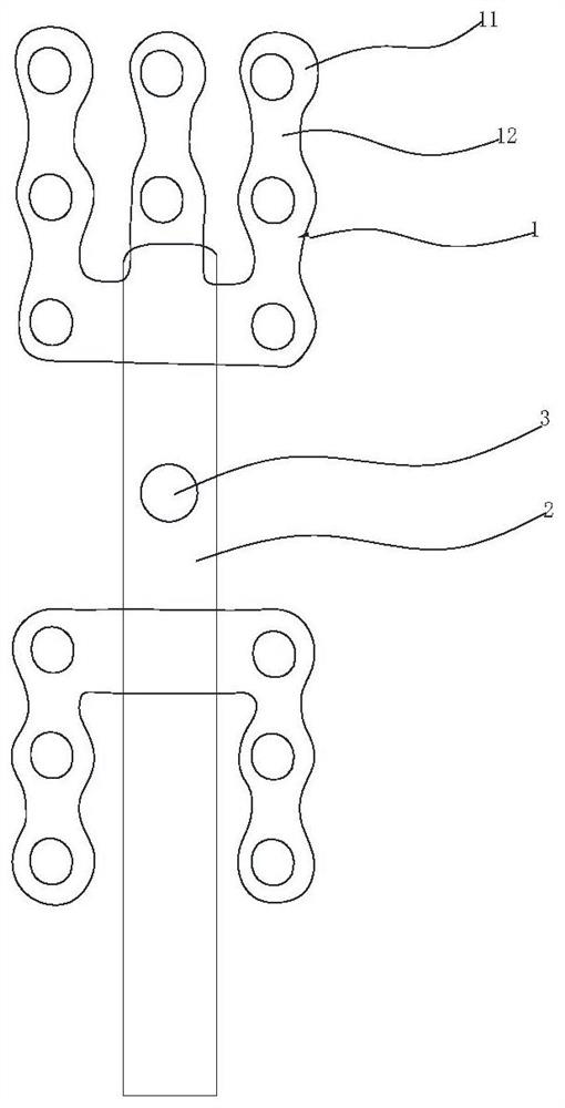 Hand and Foot Surgical Fixation System Based on Magnesium-Based Alloy or Zinc-Based Alloy