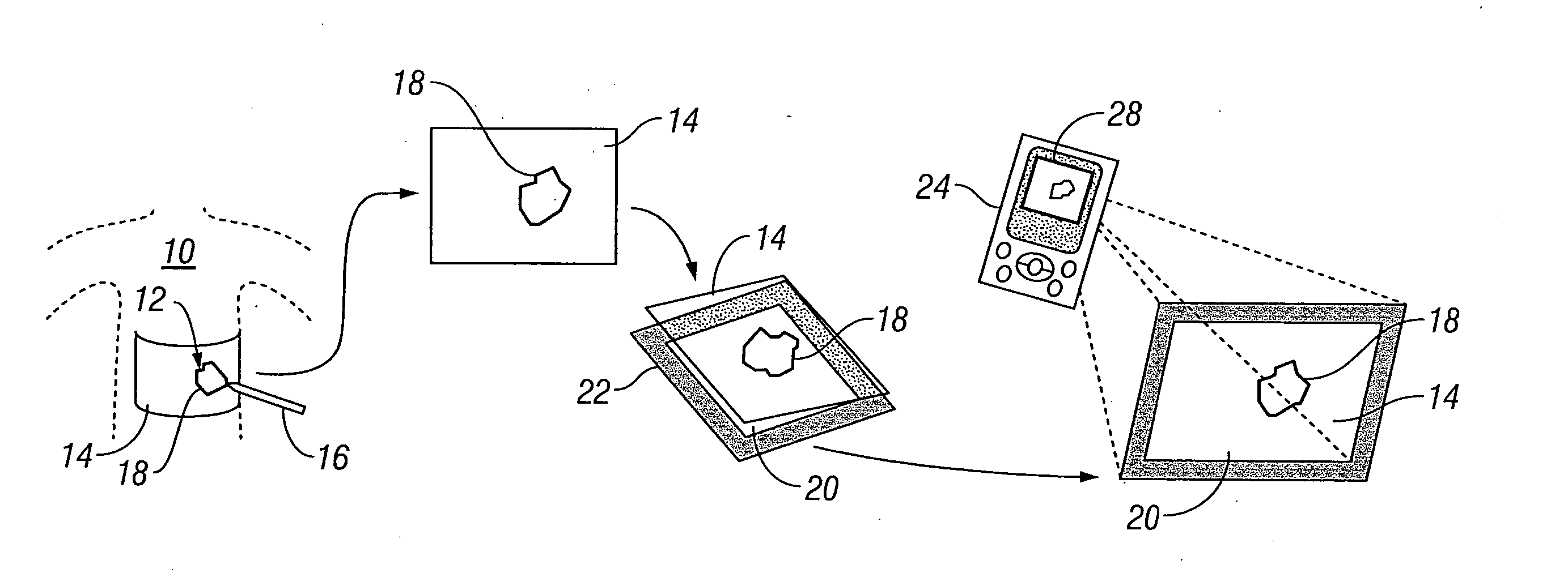 Systems and methods for wound area management