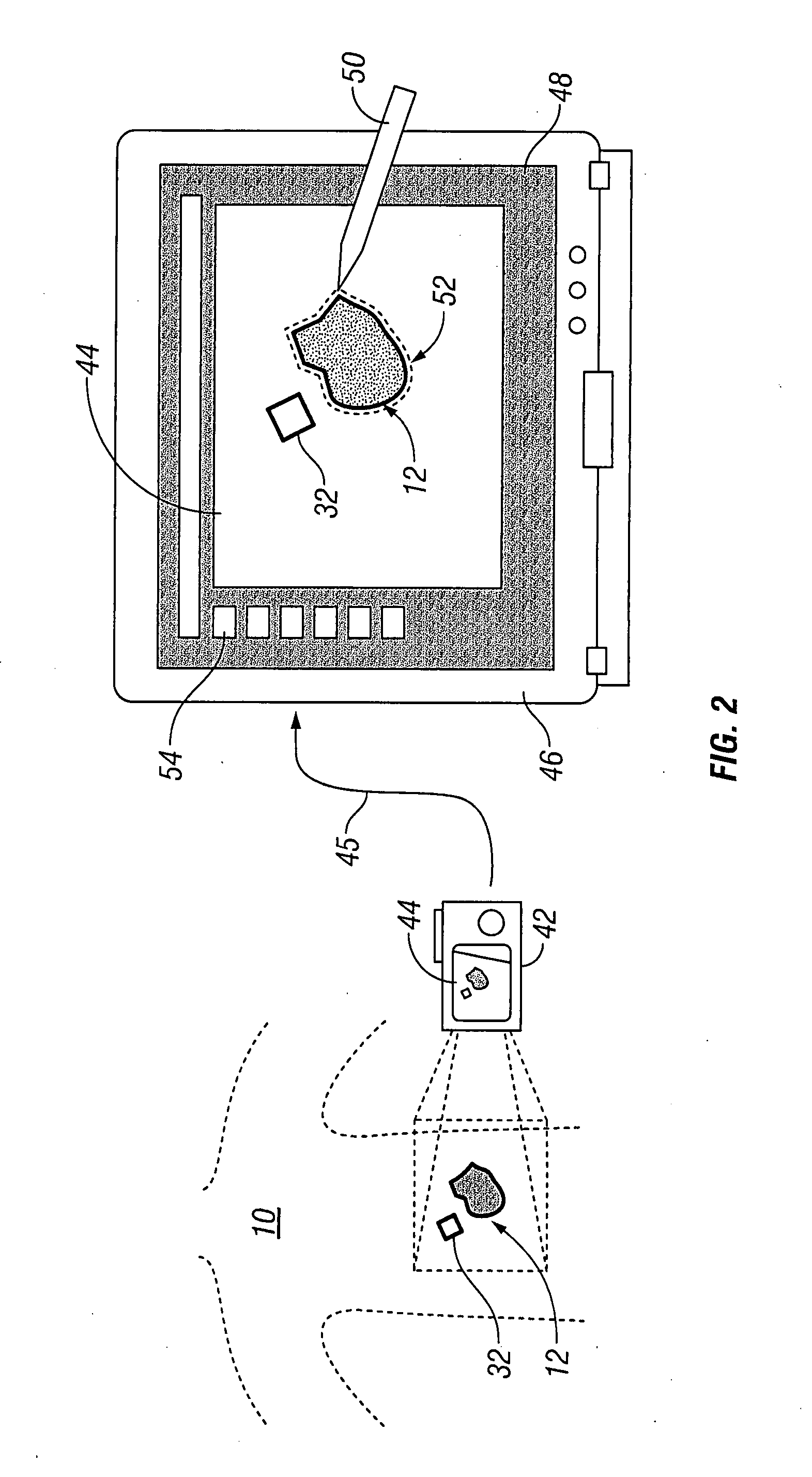 Systems and methods for wound area management