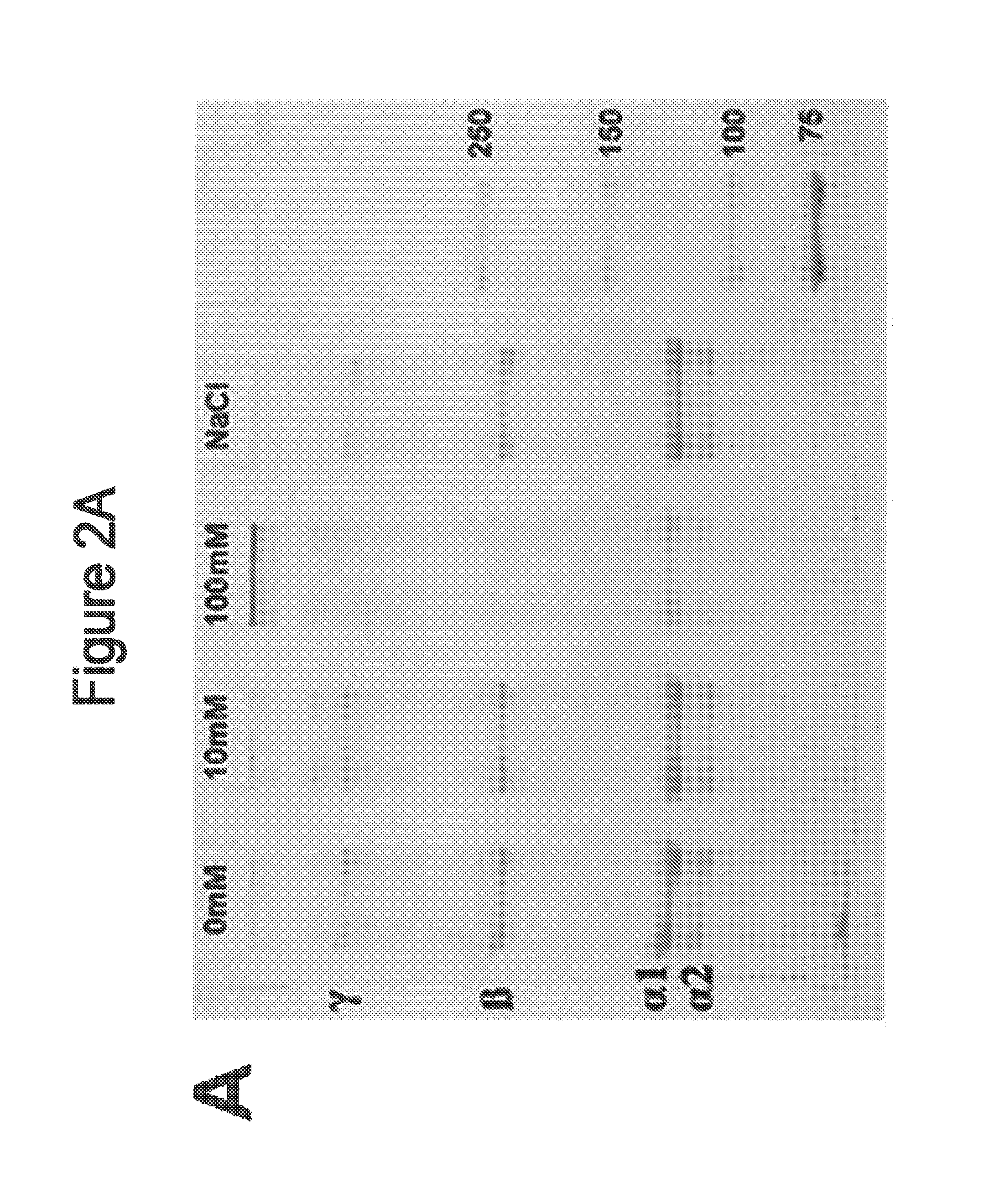 Method of stabilizing human eye tissue