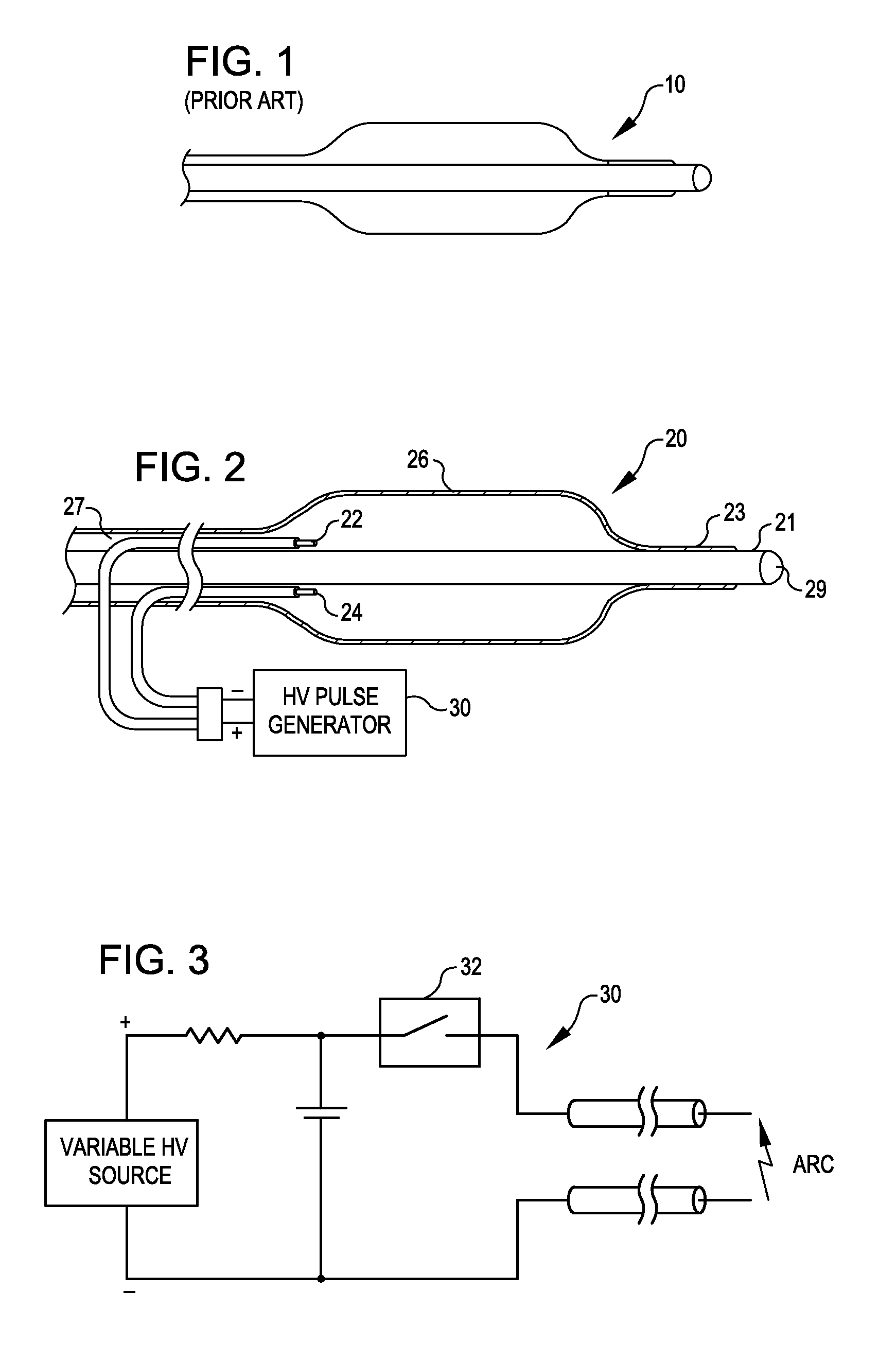 Shockwave balloon catheter system