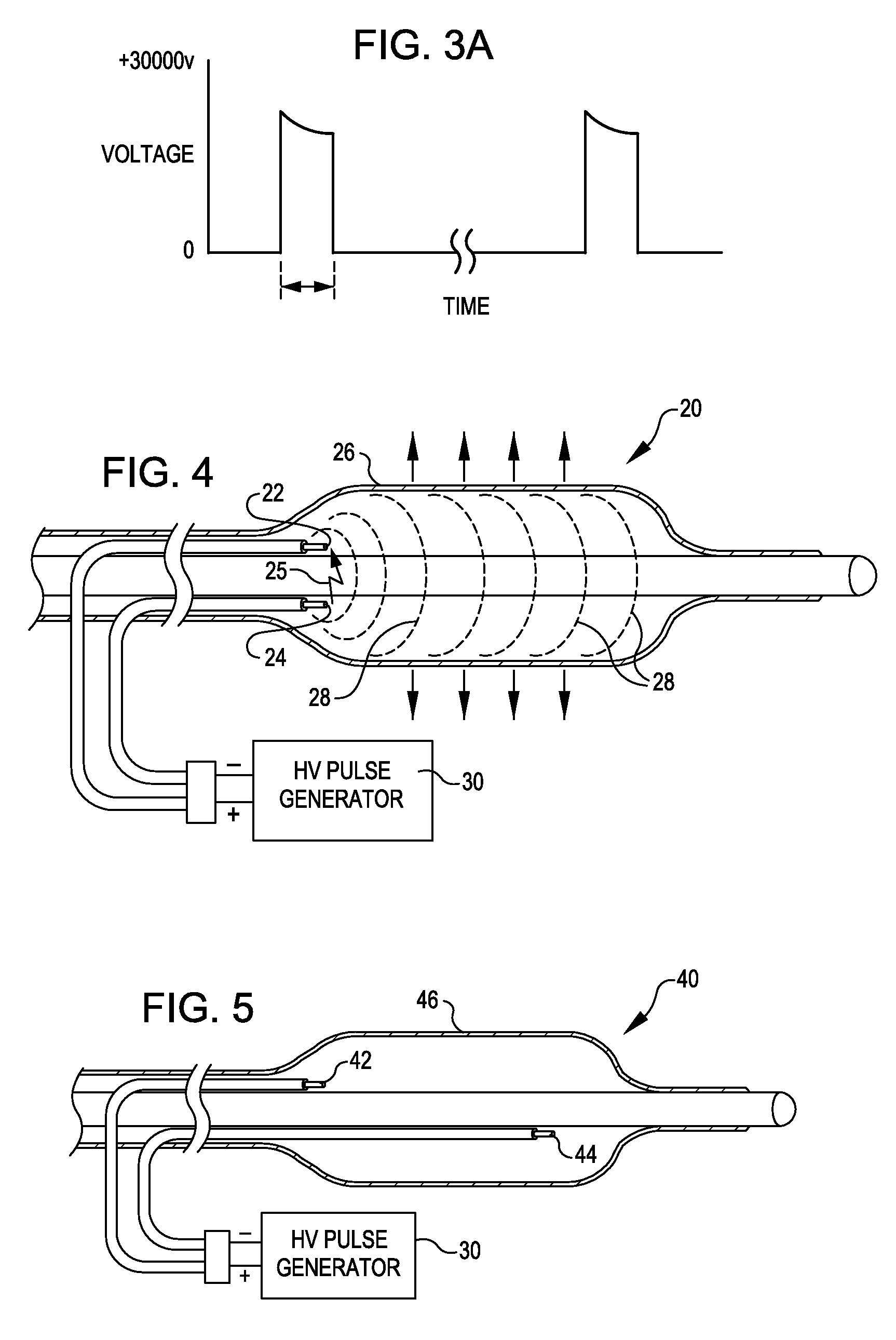 Shockwave balloon catheter system