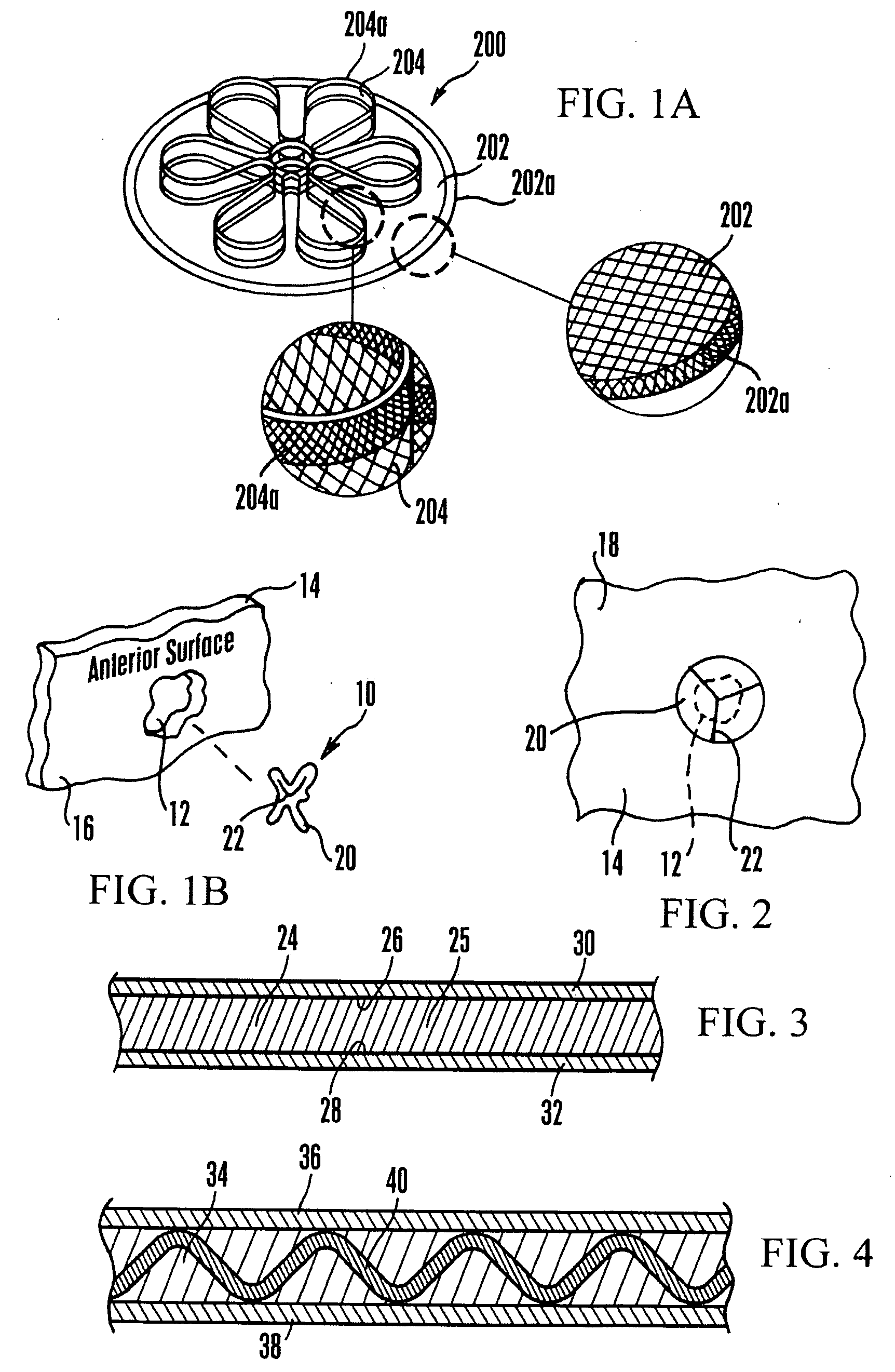 Fortified mesh for tissue repair