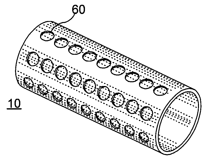 Degradable porous implant structure