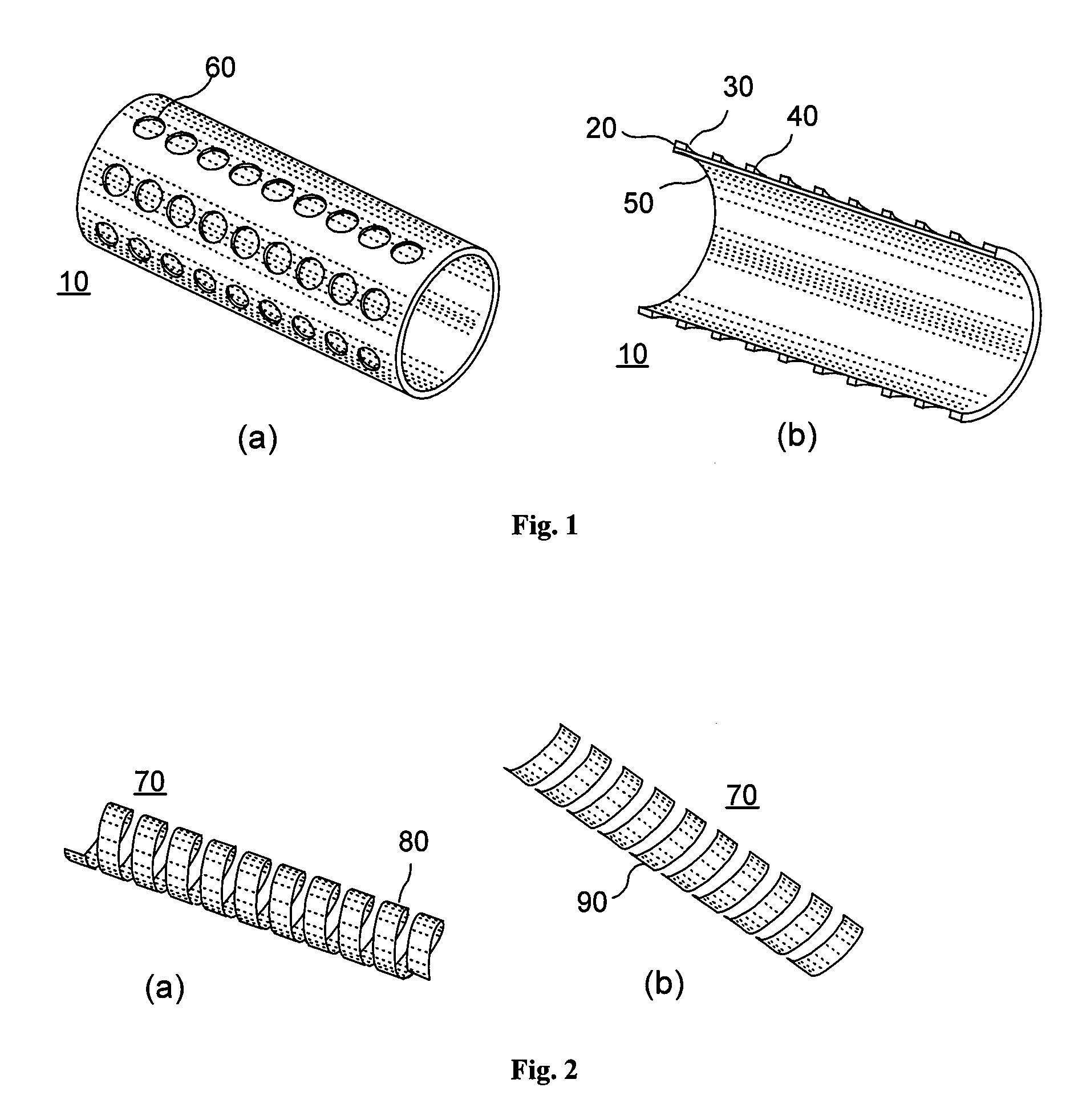 Degradable porous implant structure