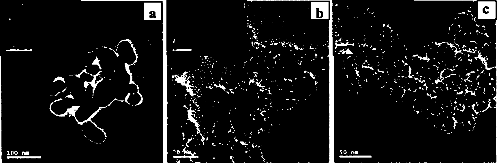 General method for preparing spherical porous metal oxide