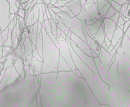 Radiation-proof Fusarium sp. and application thereof to cesium adsorption biotreatment