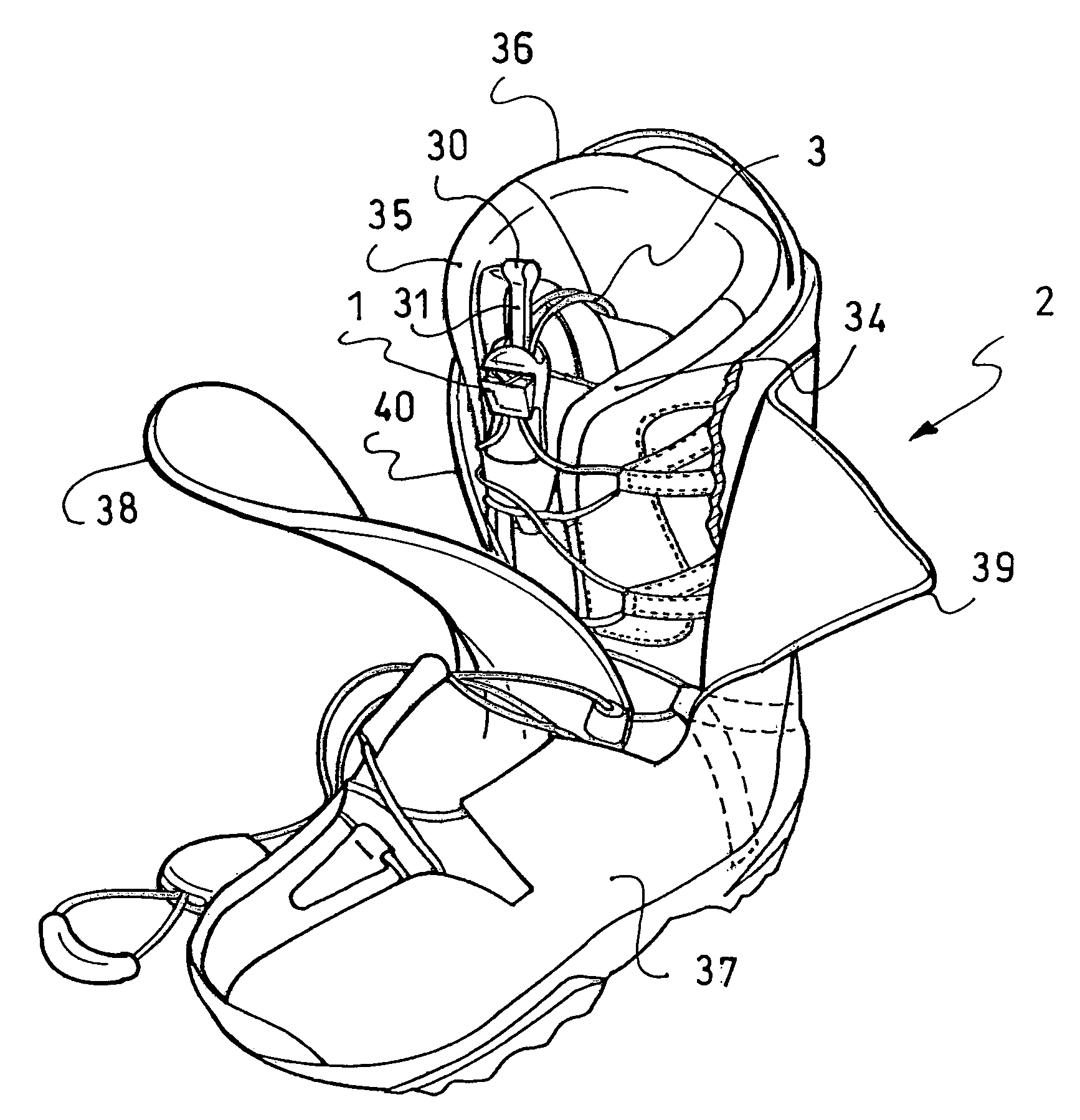 Lace blocking device