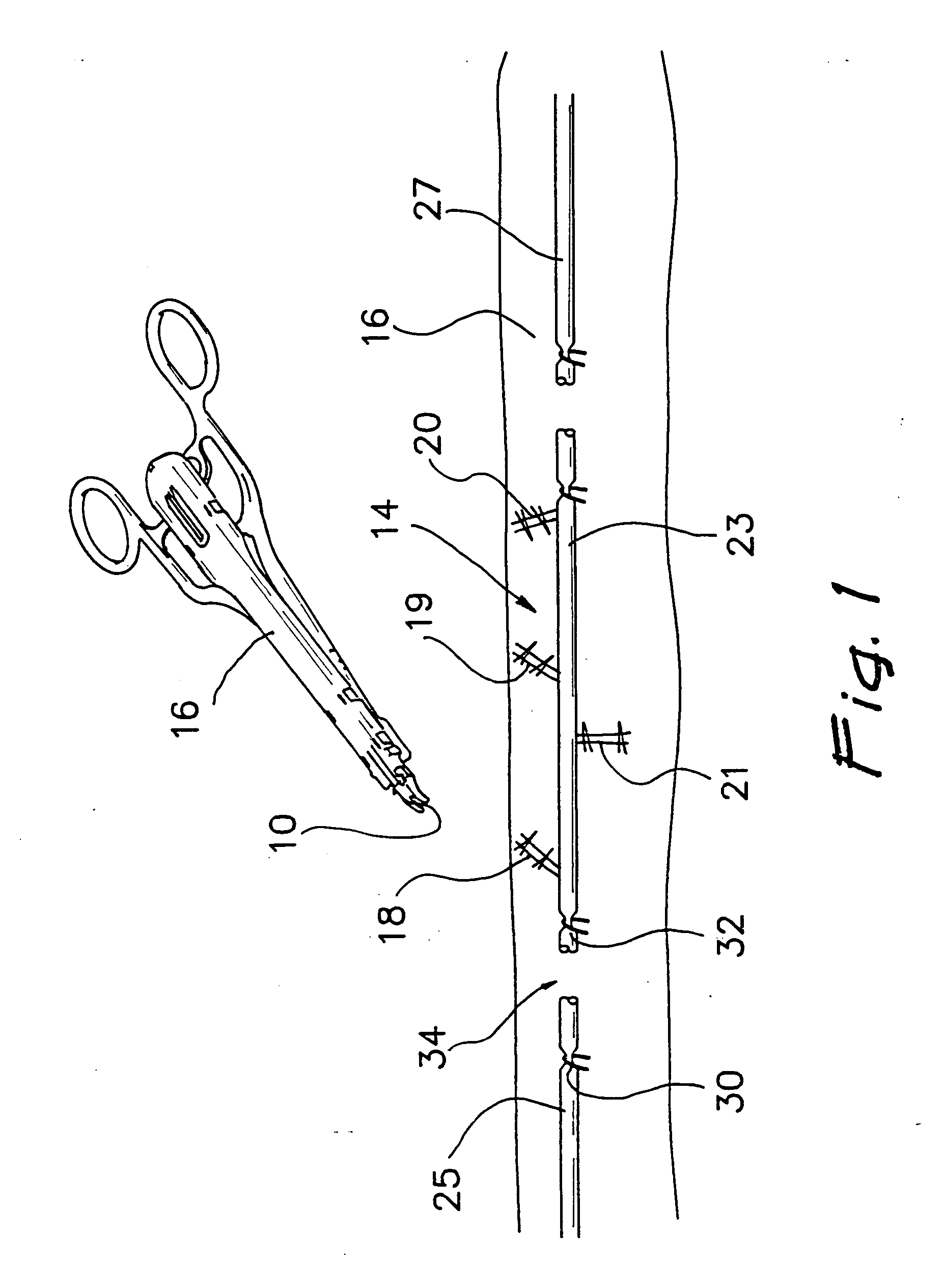 Surgicals metals with improved hardness and methods for making same