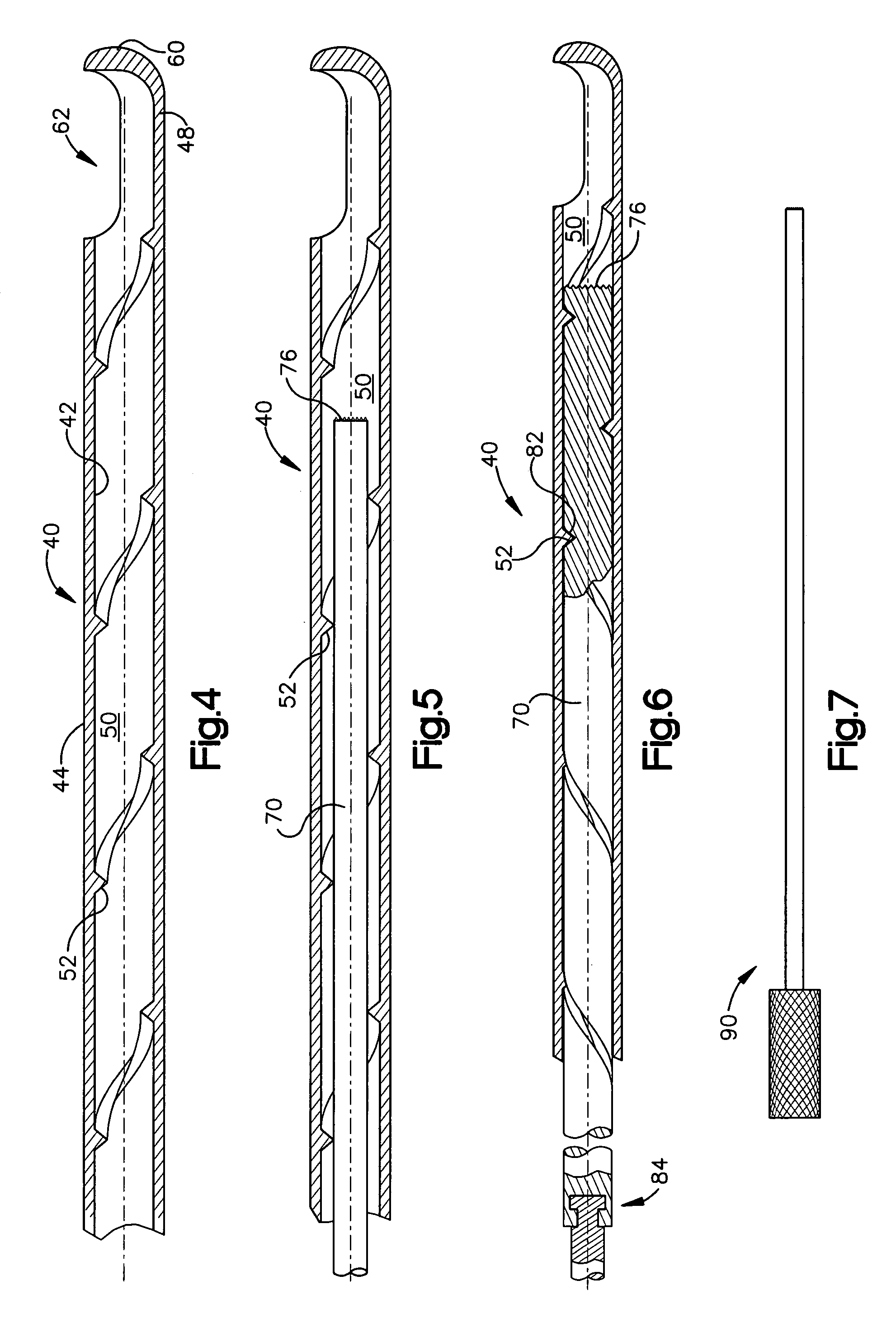 Apparatus for depositing bone grafting material