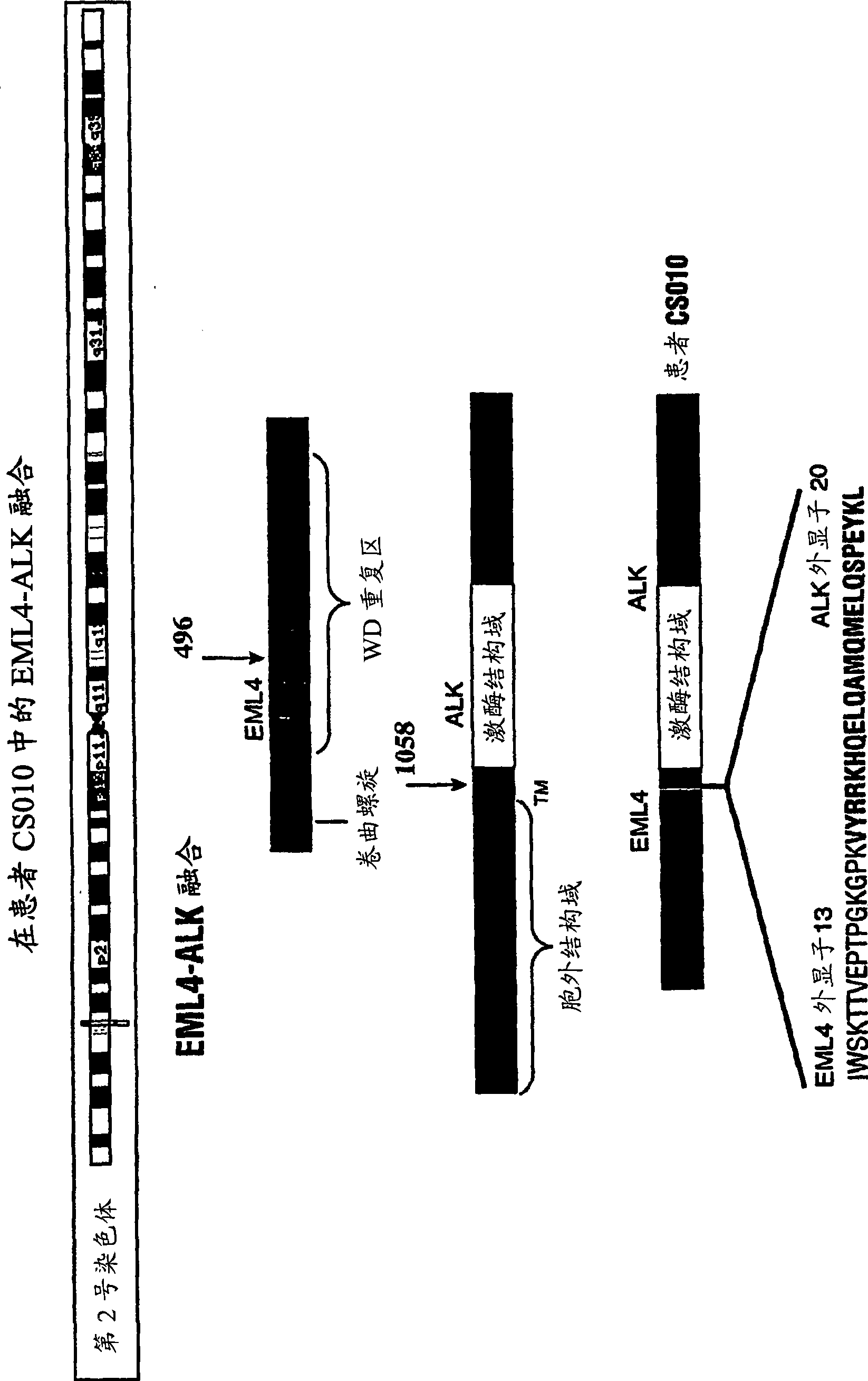 Gene defect and mutant ALK kinase in human entity tumour