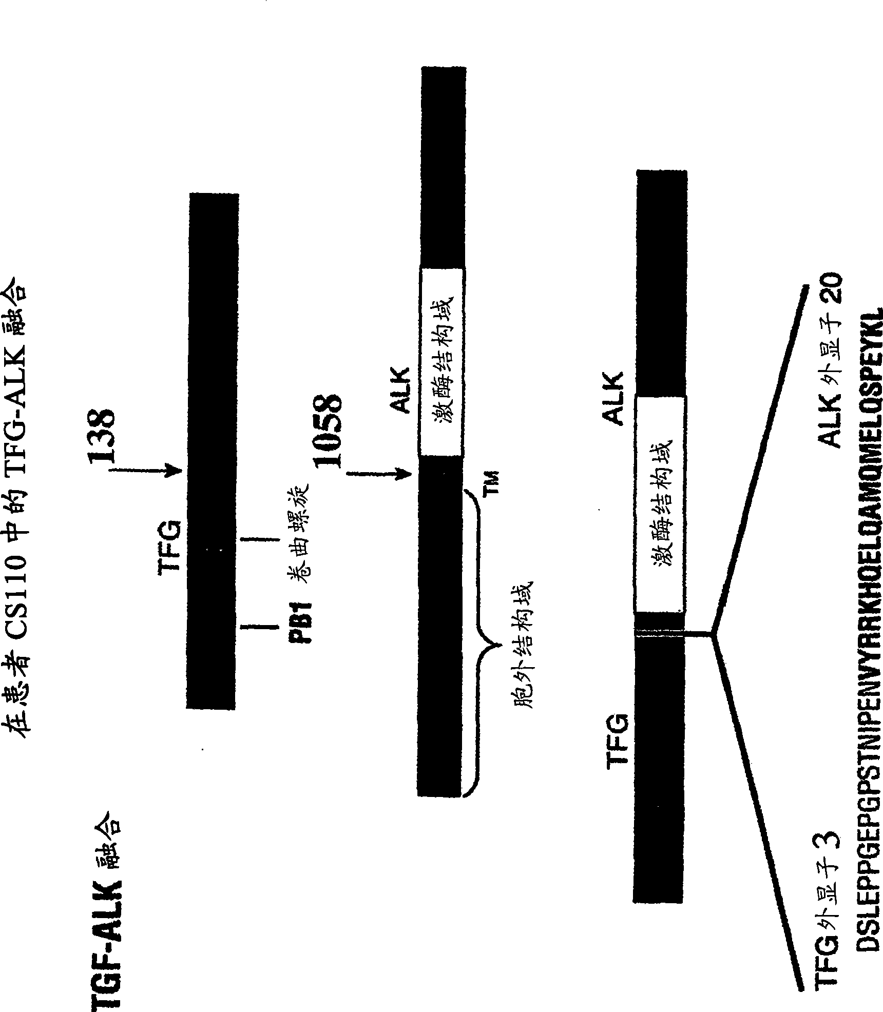 Gene defect and mutant ALK kinase in human entity tumour