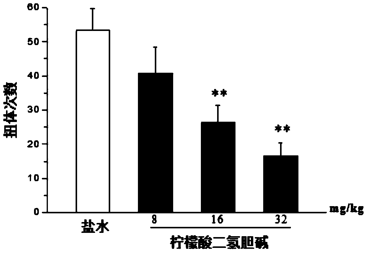 A pharmaceutical composition for treating and/or preventing inflammatory pain and its application