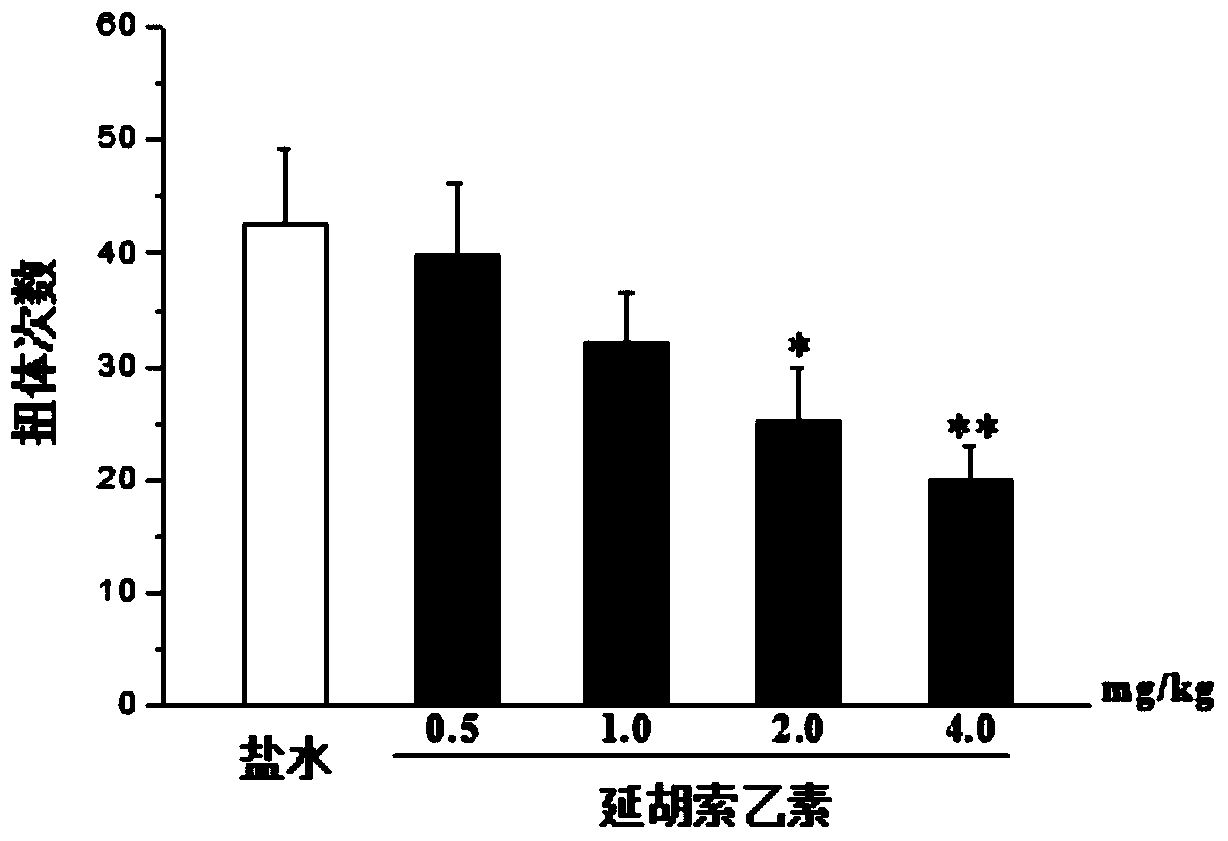 A pharmaceutical composition for treating and/or preventing inflammatory pain and its application