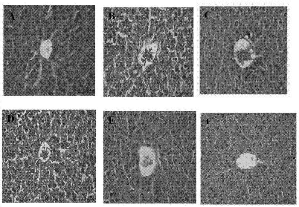 Application of matteuccia struthiopteris total triterpenes in protection of acute alcoholic liver injury