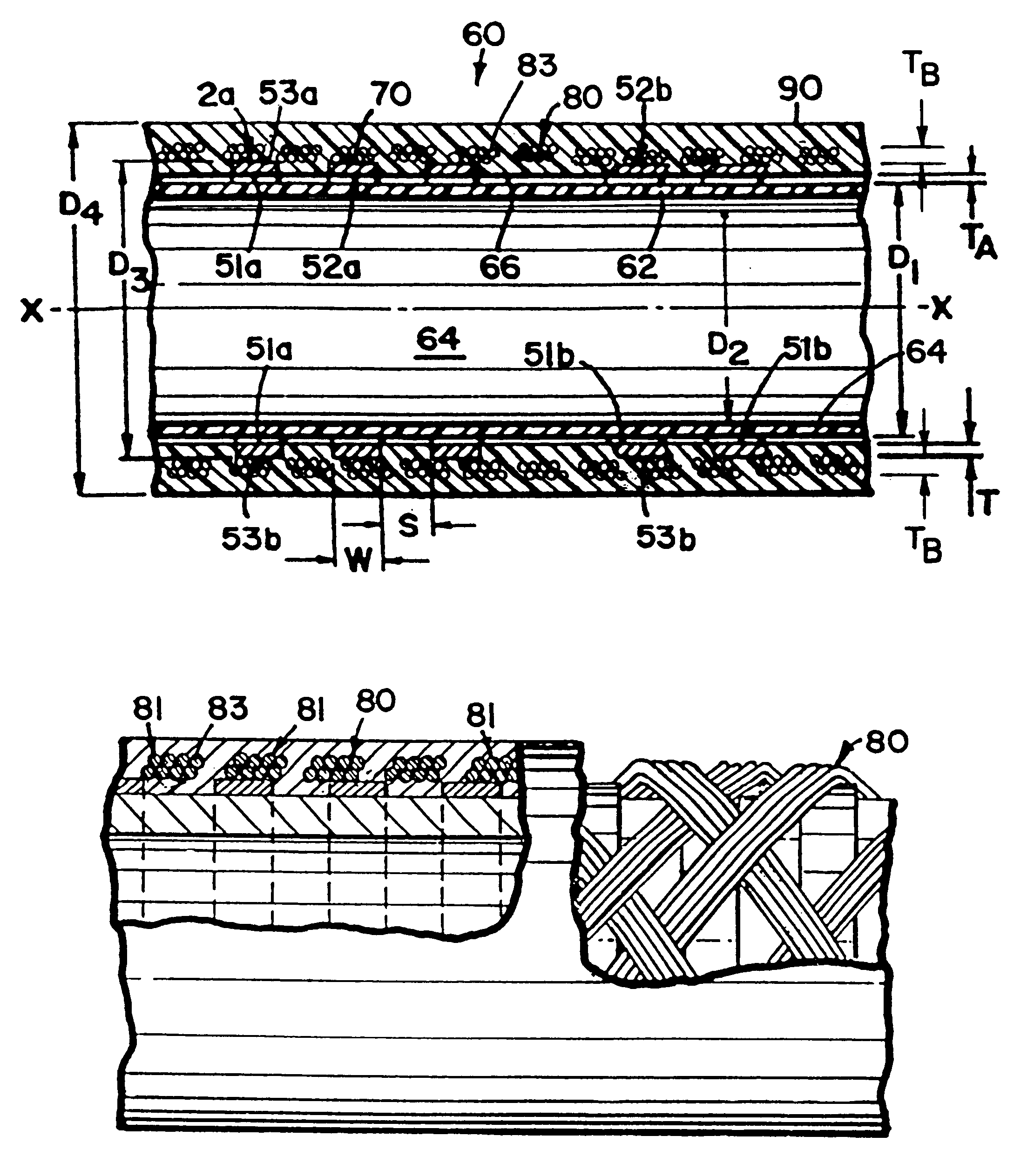 Catheter support structure