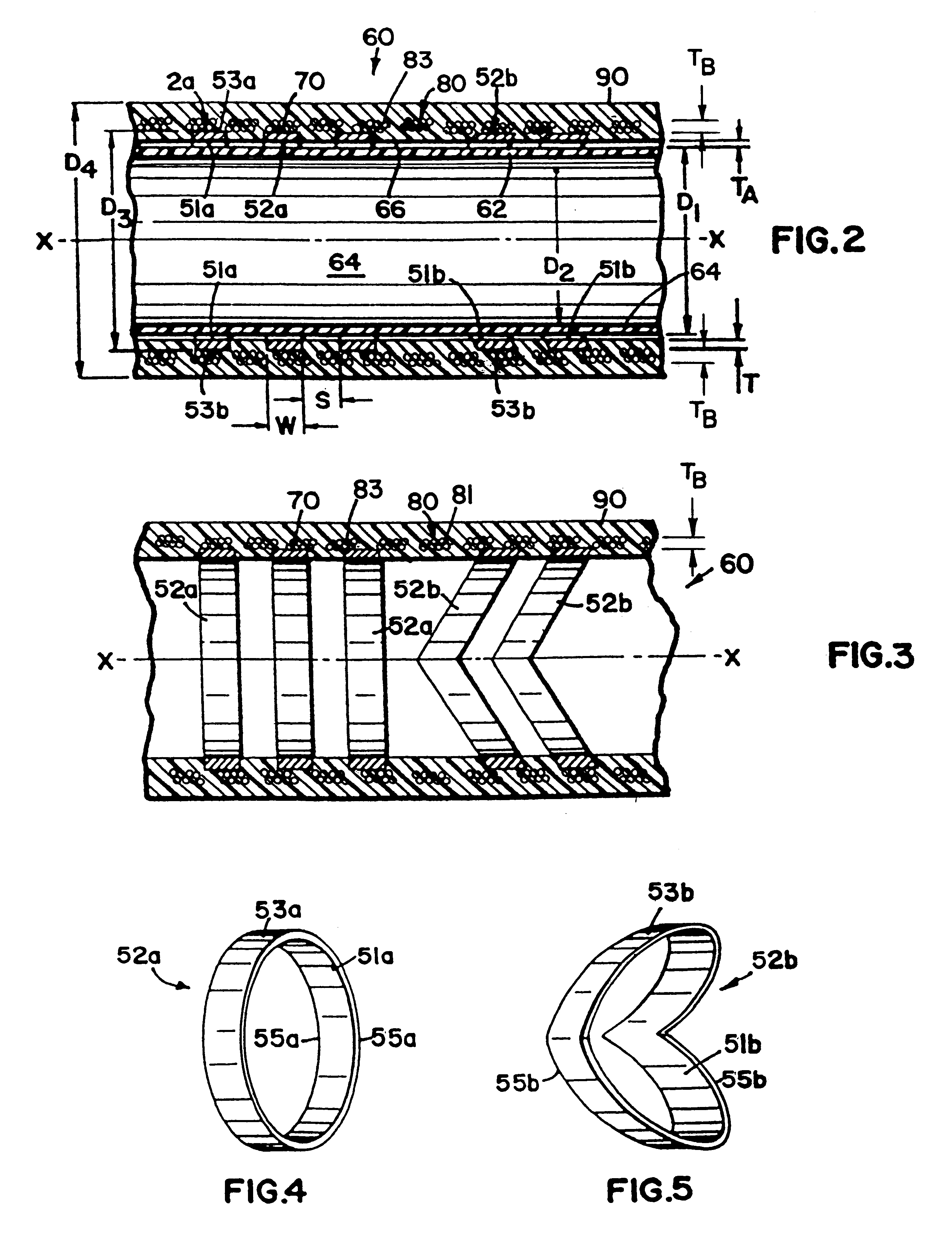 Catheter support structure