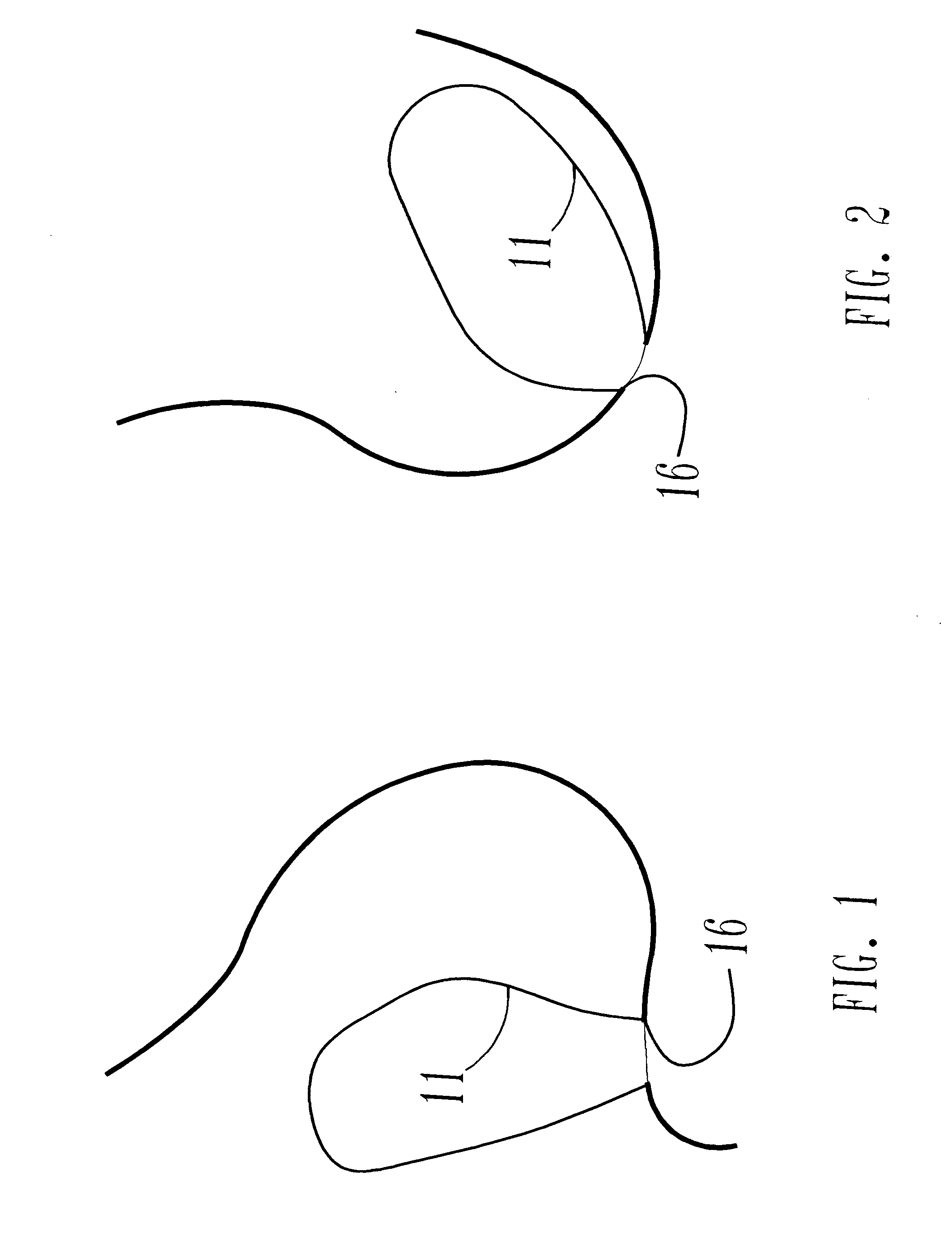 Apparatus and method for drainage