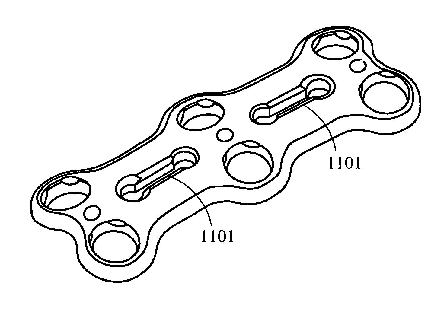 Bone fixation plate