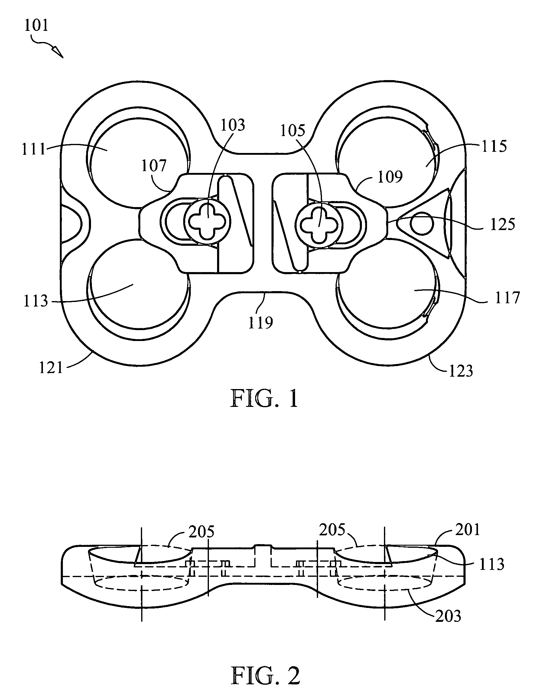 Bone fixation plate