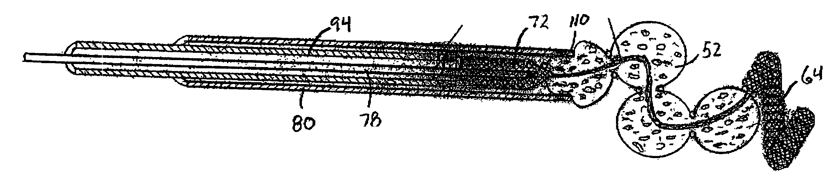 Aneurysm treatment devices and methods