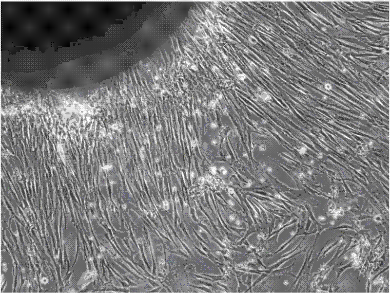 Preparation of human platelet-rich plasma and application of same in isolation and culture of human mesenchymal stem cells