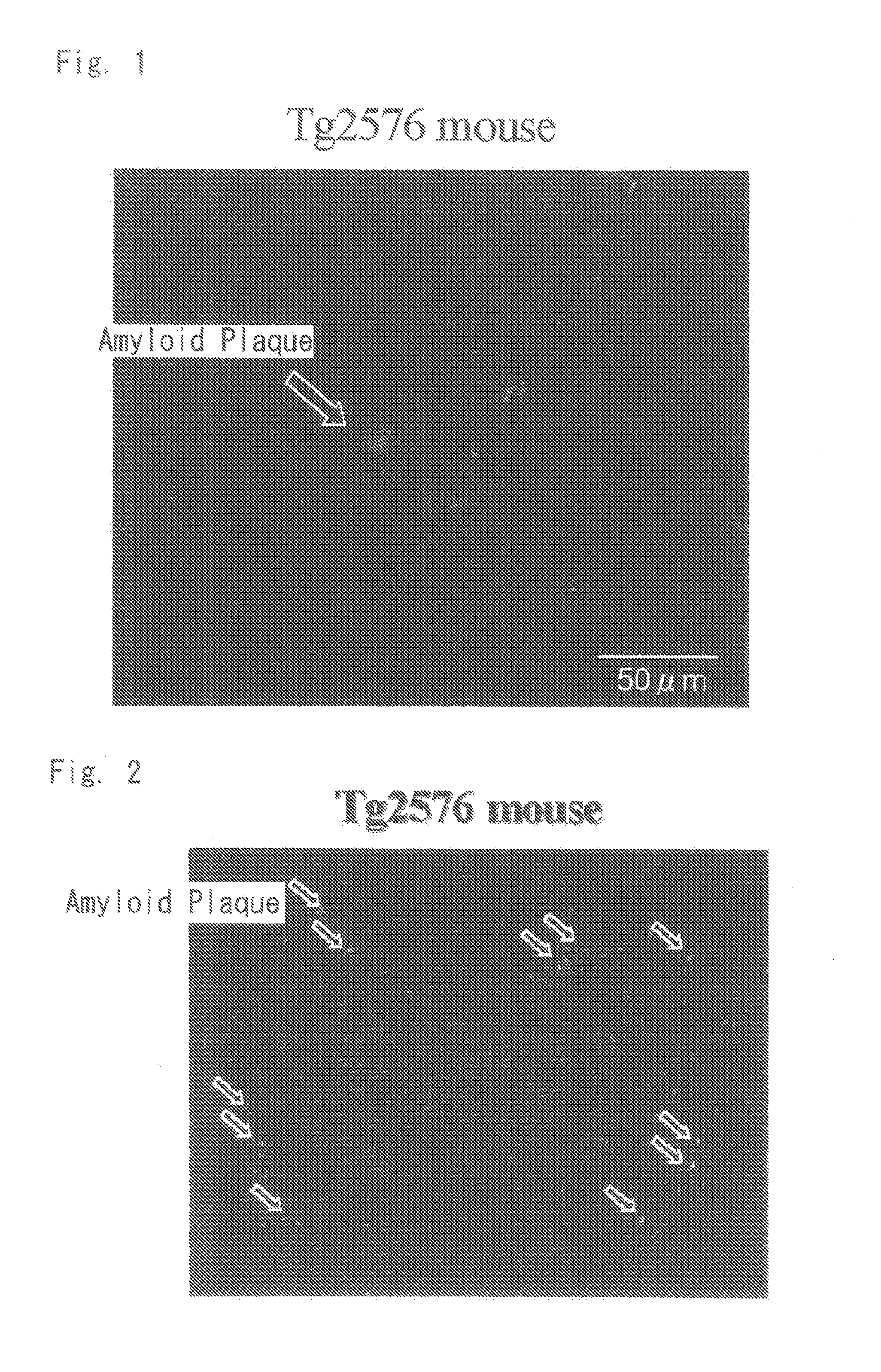 Diagnostic probe for conformation disease