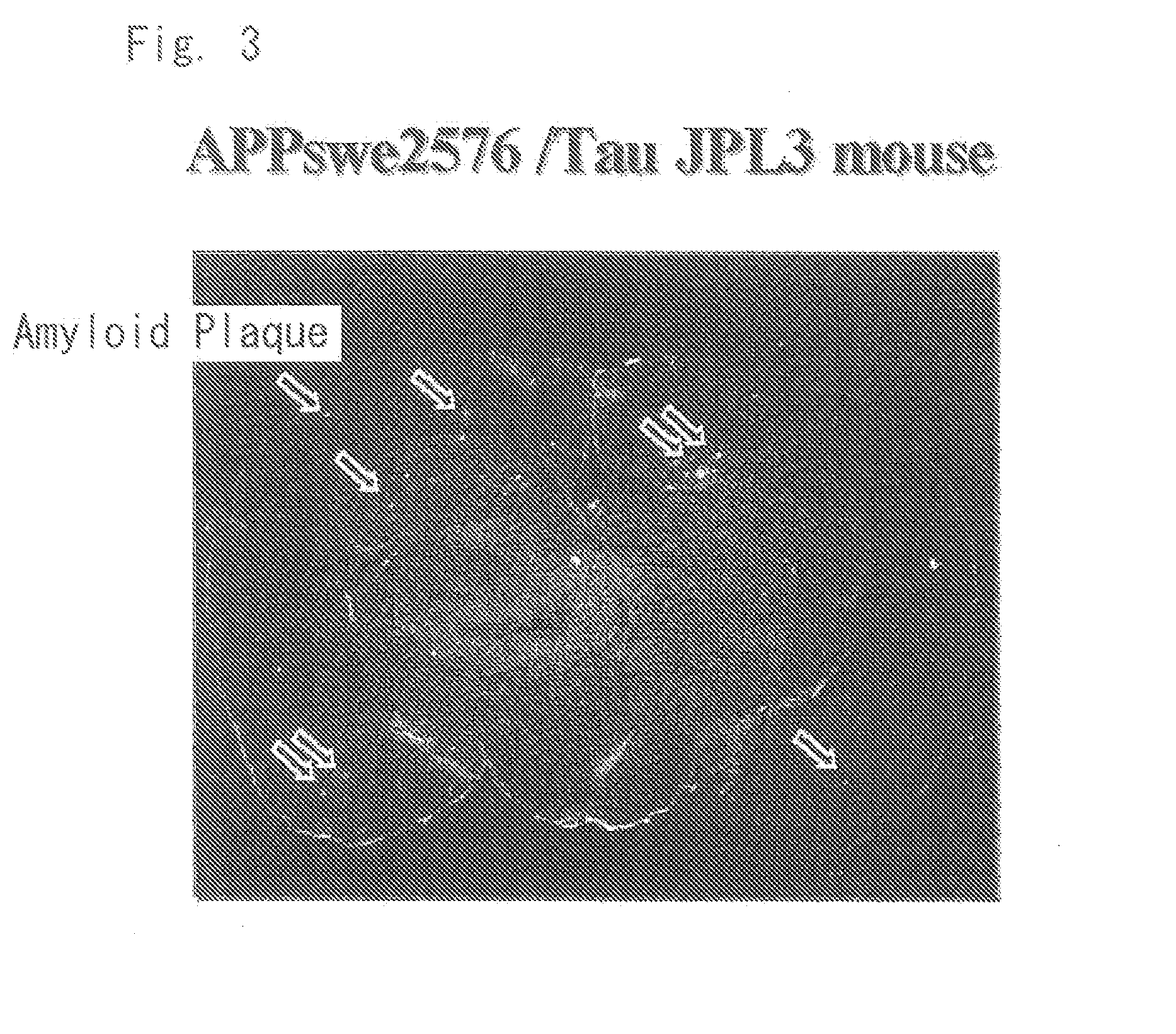 Diagnostic probe for conformation disease