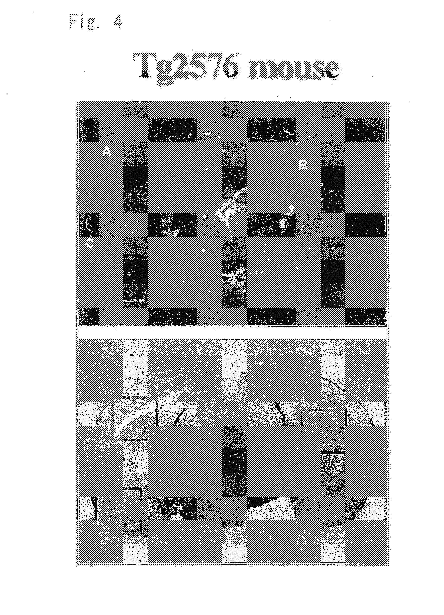 Diagnostic probe for conformation disease