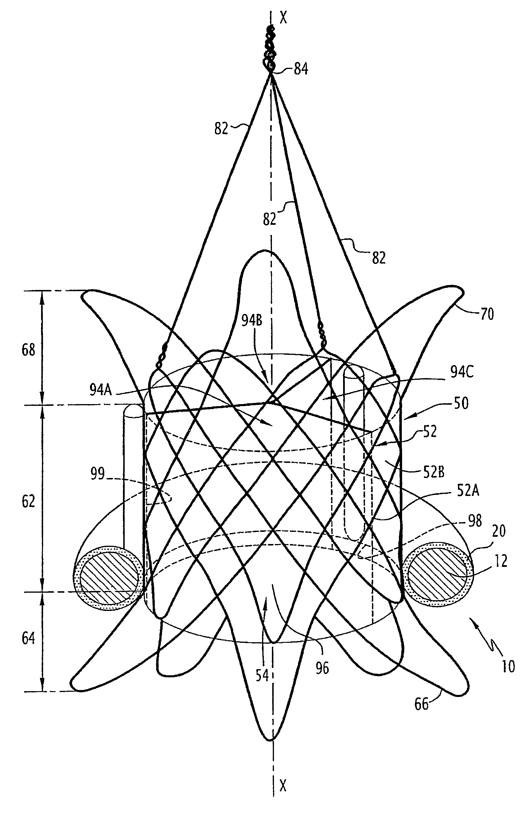 Valve prosthesis