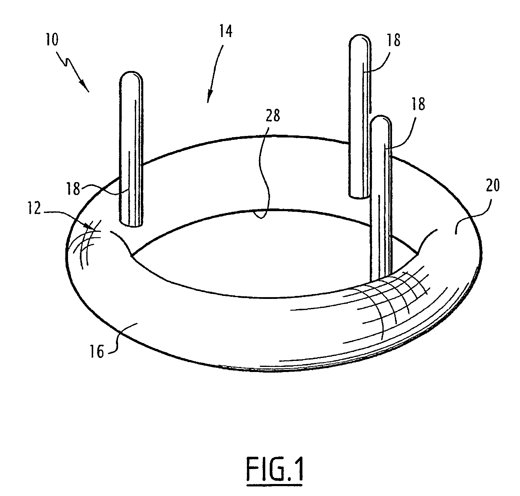 Valve prosthesis