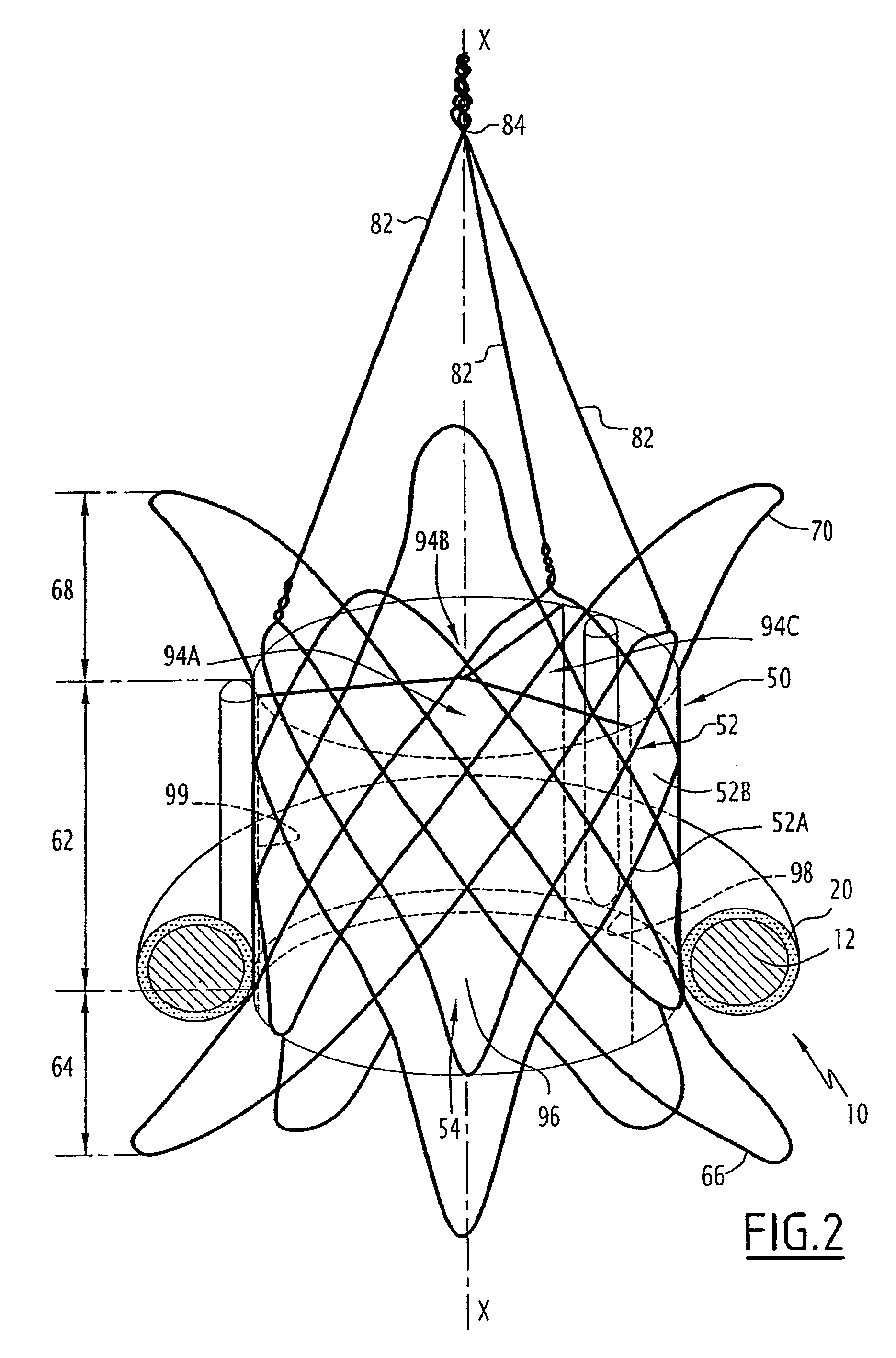 Valve prosthesis