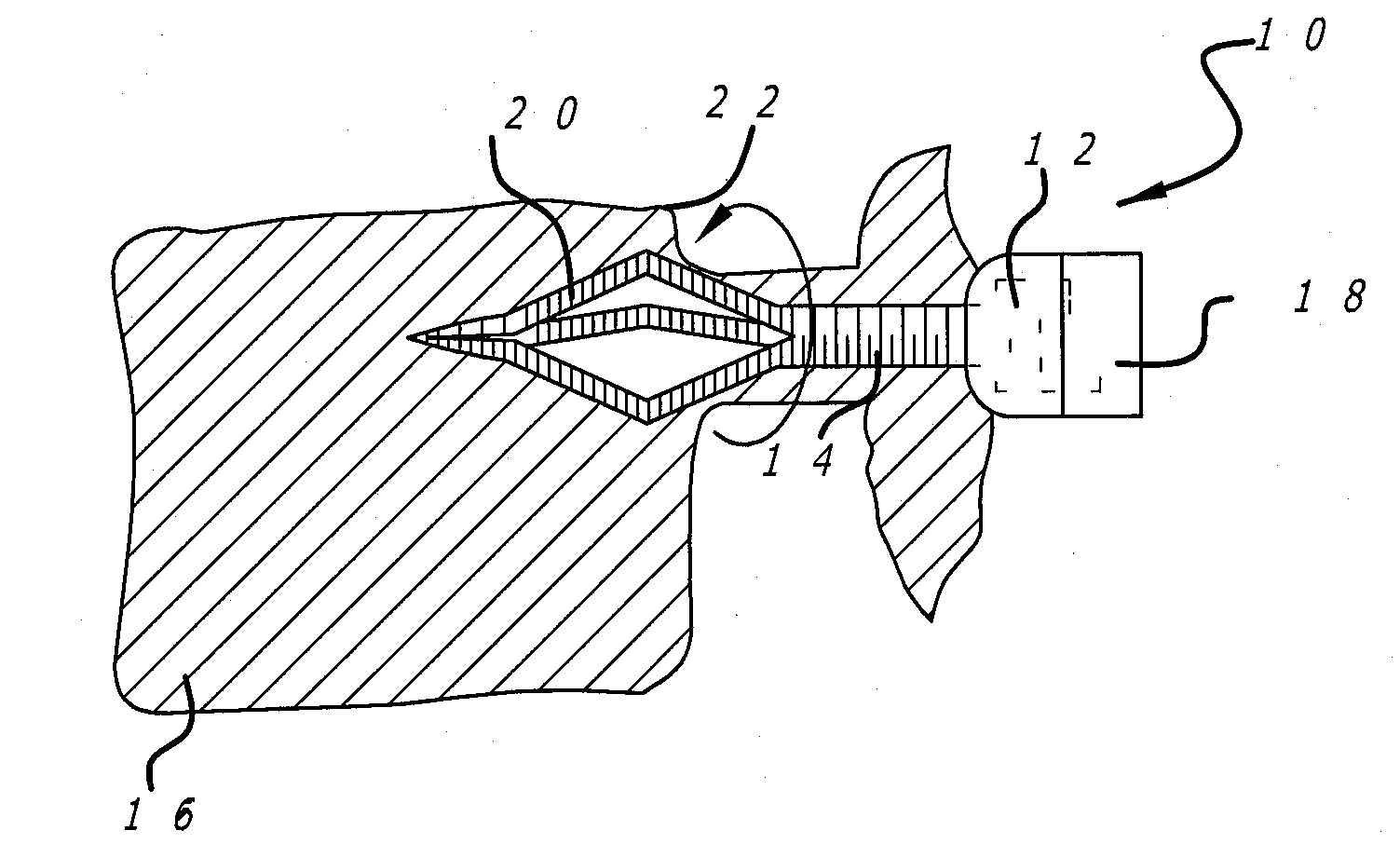 Reversibly expandable fixation device