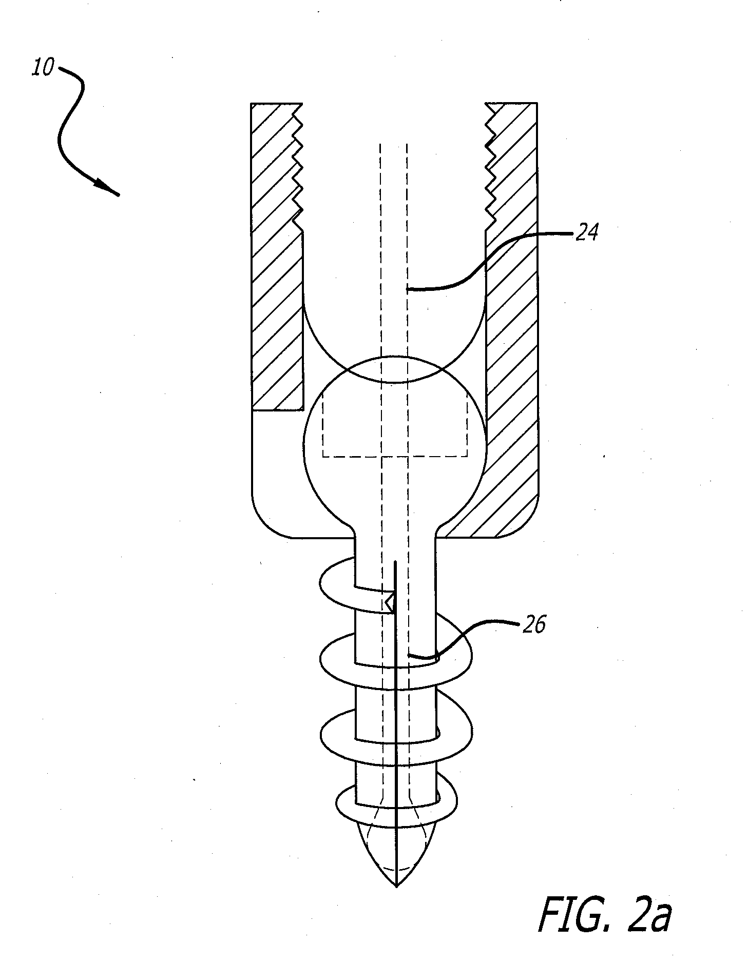 Reversibly expandable fixation device