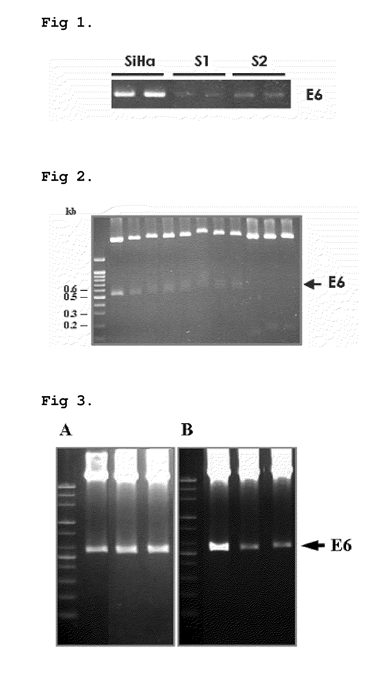 Cell line stably expressing mutated oncoprotein E6 and method of screening anticancer compound of uterine cervical cancer using the same