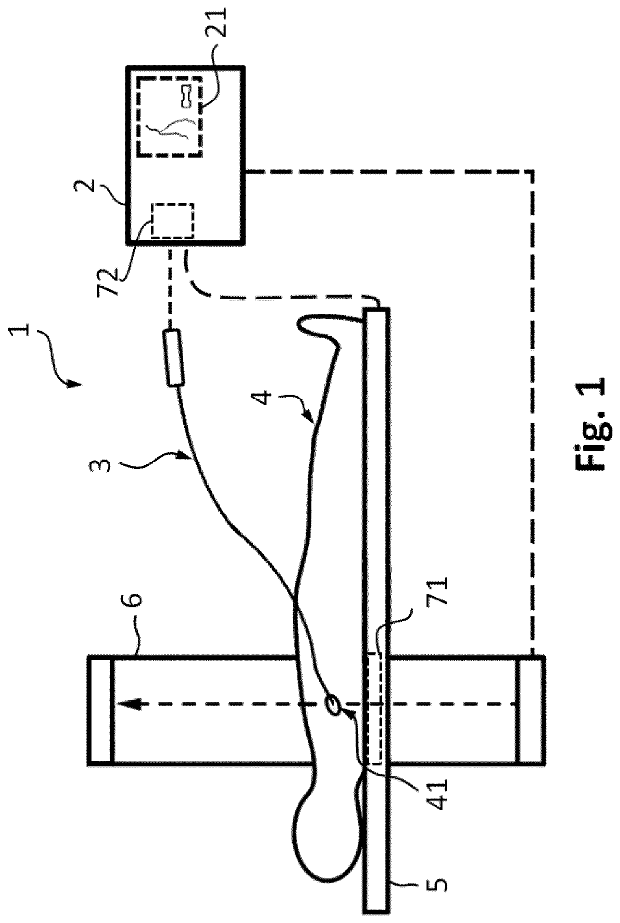 Apparatus for vessel characterization