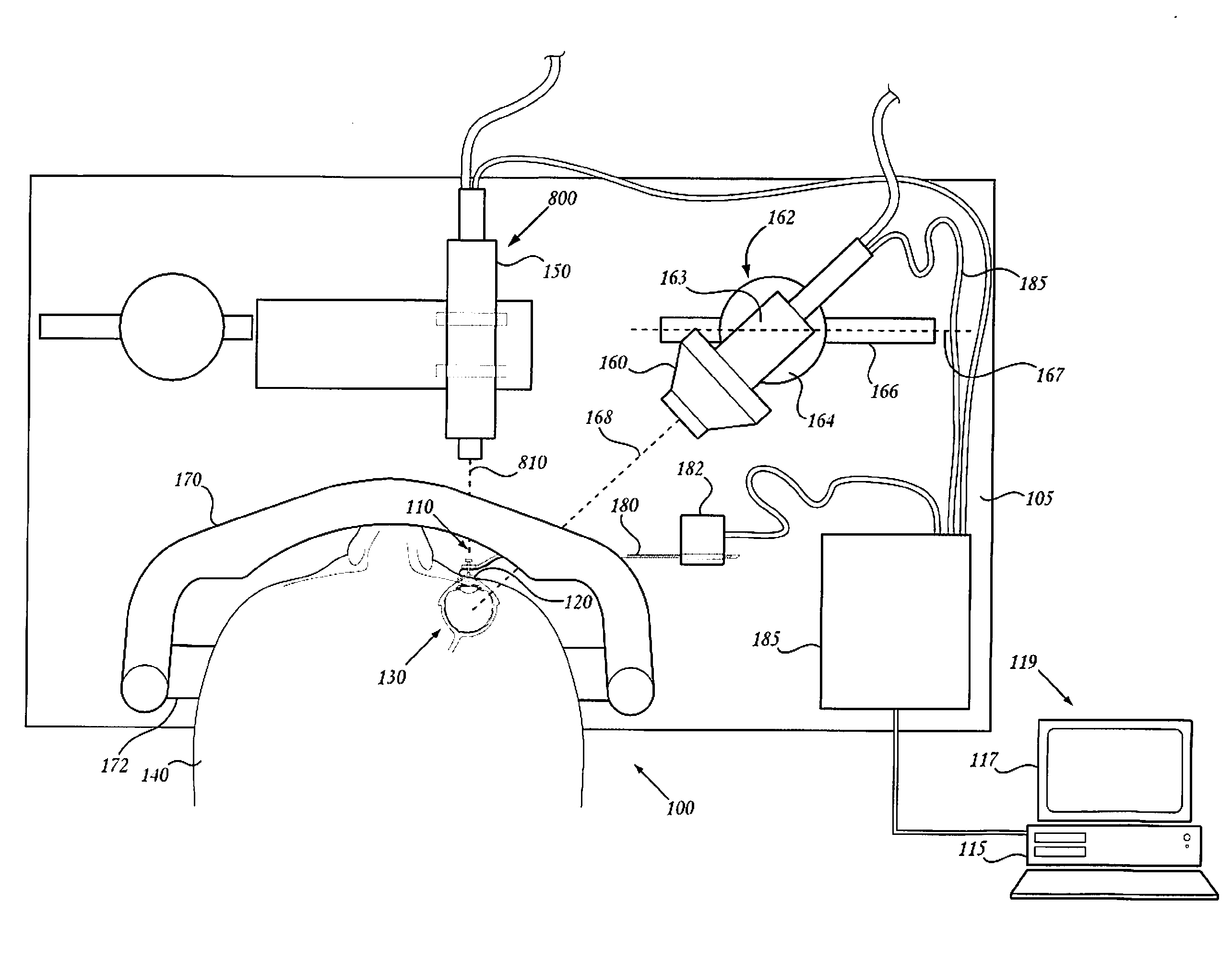 System and method for performing an ocular irradiation procedure