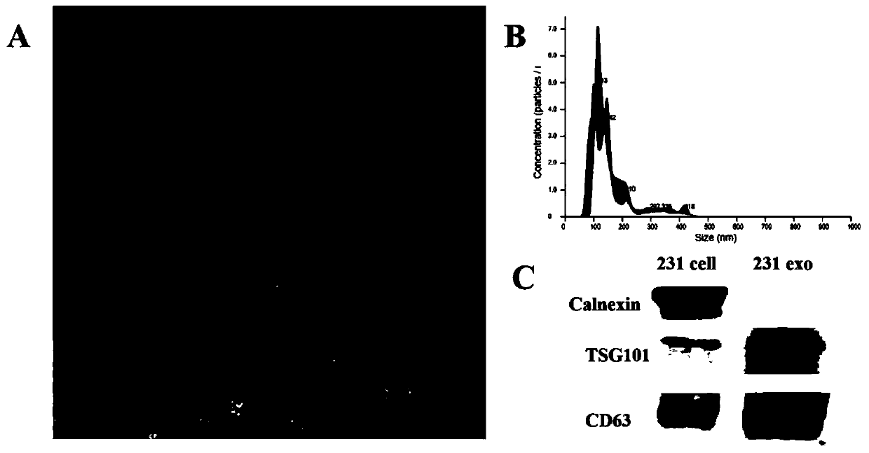 Exosome double-membrane protein co-expression detection platform based on magnetic separation and catalytic hairpin assembly as well as preparation method and application of exosome double-membrane protein co-expression detection platform