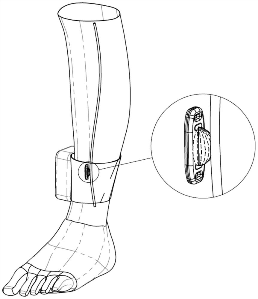 Implantable tibial nerve stimulation system