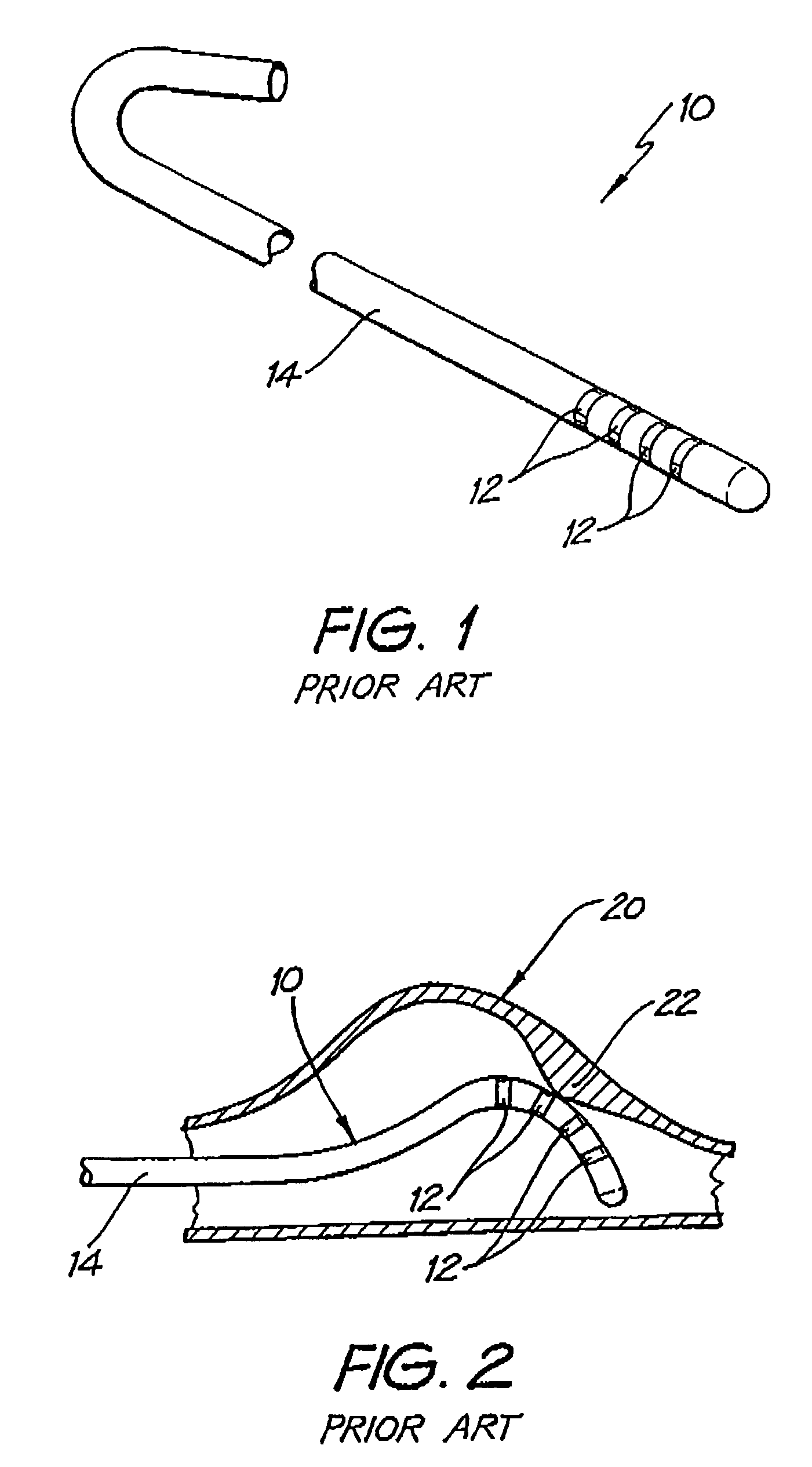 Intraoperative endocardial and epicardial ablation probe