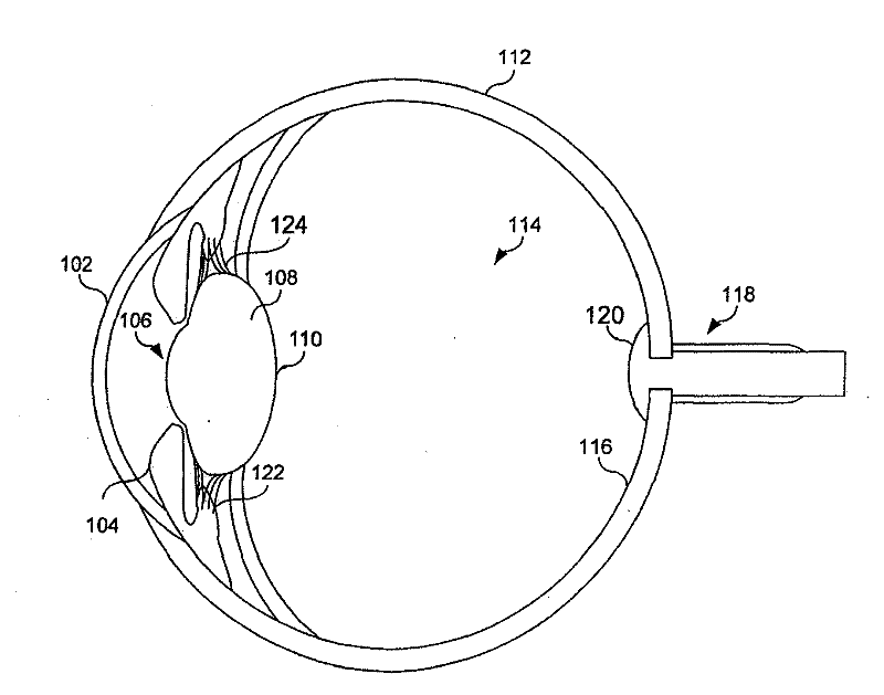 Accommodating intraocular lens