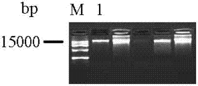 FOXP3 (forkhead/winged helix transcription factor 3) gene methylation detection method based on bisulfite sequencing