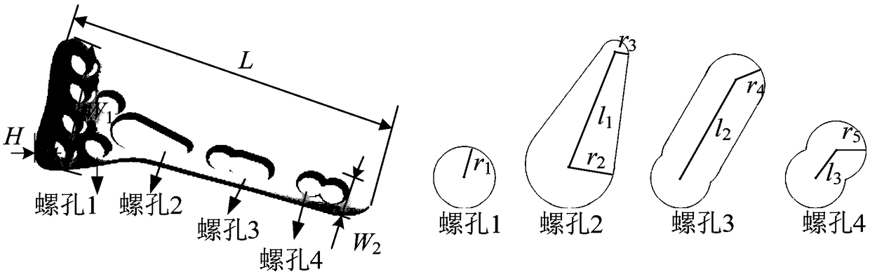 Orthopedics preoperative planning-oriented implant feature parameter editing method