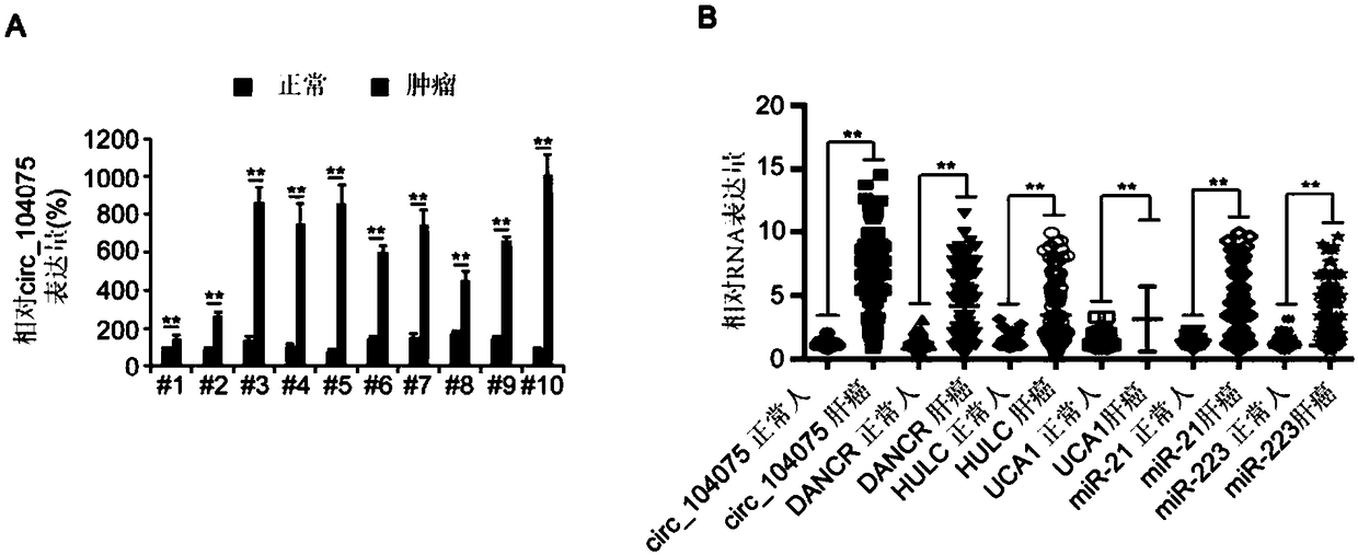 circRNA marker for liver cancer diagnosis