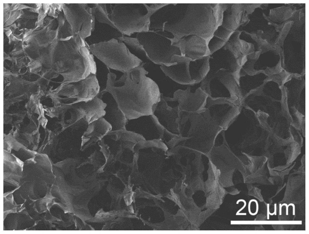 Preparation method of novel injectable drug-loaded hydrogel for treating osteosarcoma