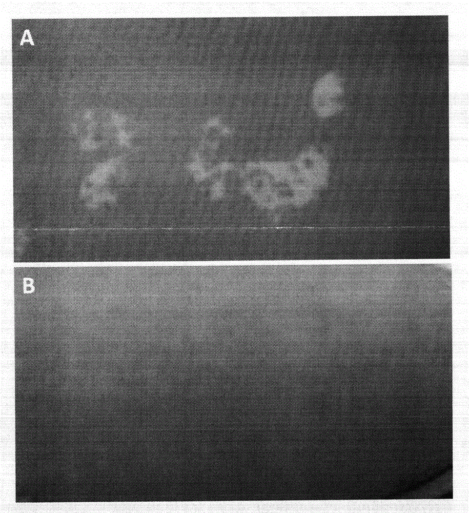 Simultaneous autologous epidermic cell and fibrocyte preparation method and biological cosmetic product thereof