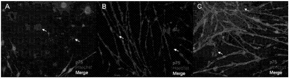 Method for culturing sciatic nerve Schwann cells