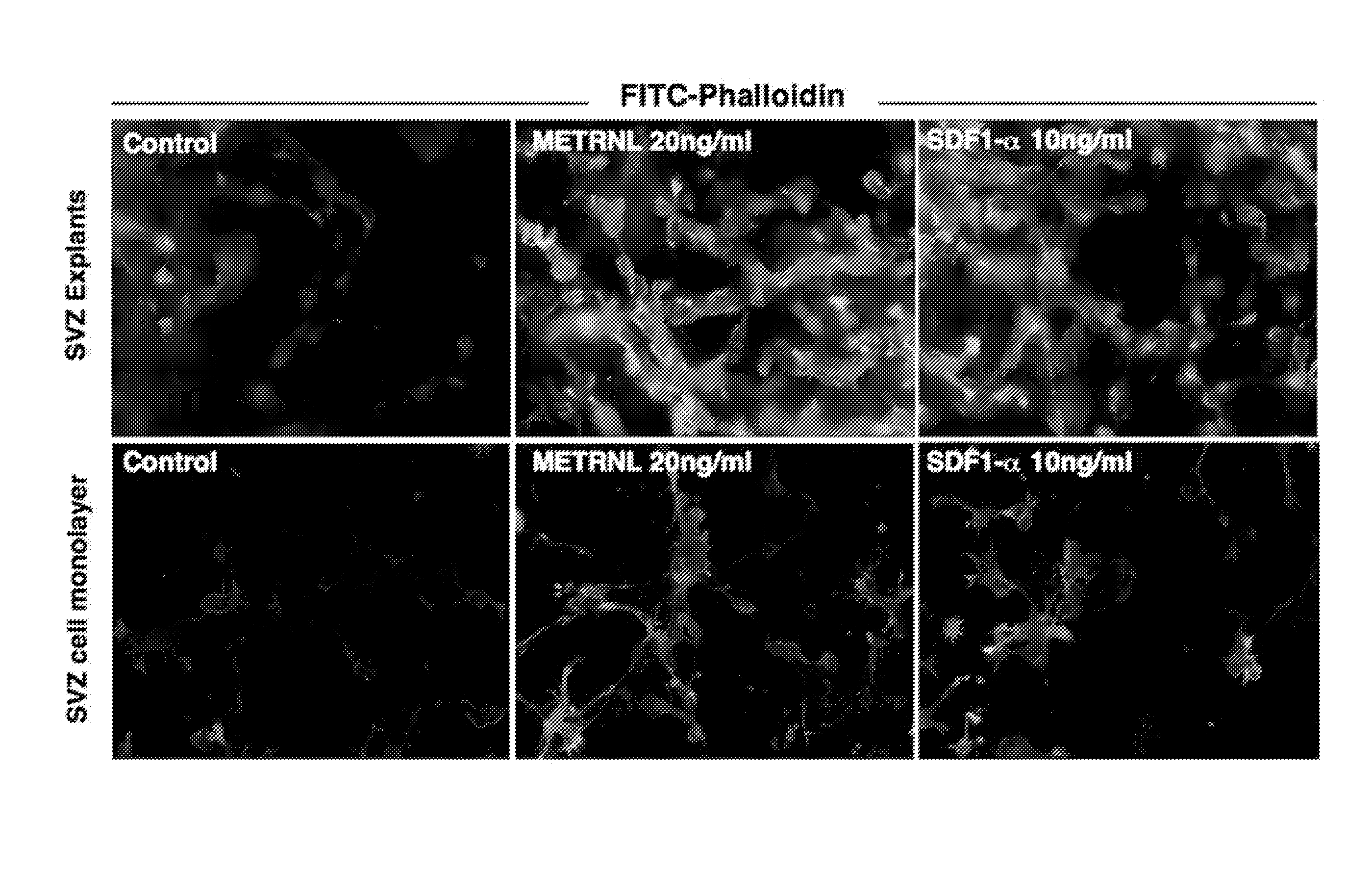 Therapeutic use of a growth factor, metrnl