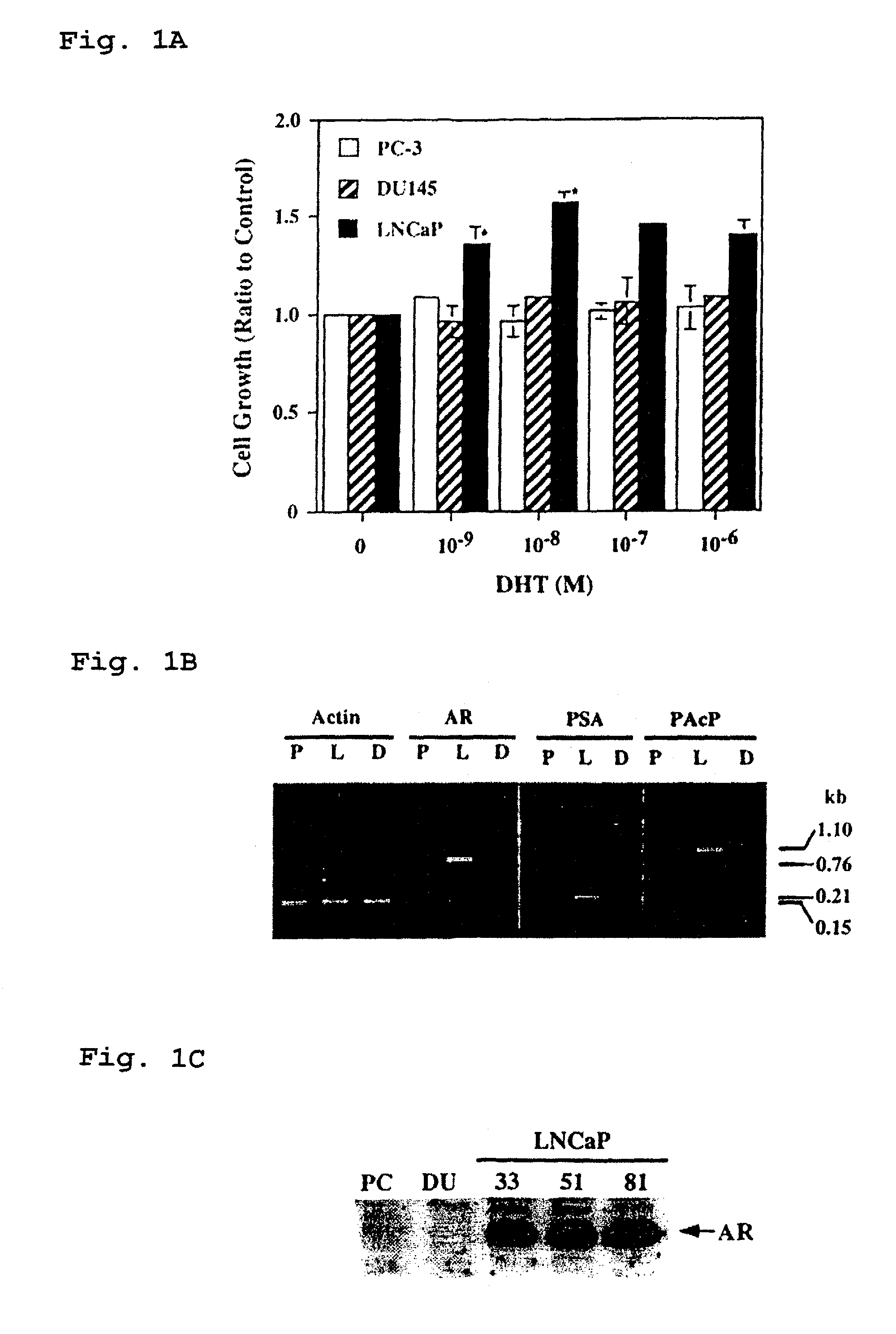 Therapeutic and diagnostic applications of prostatic acid phosphatase in prostate cancer